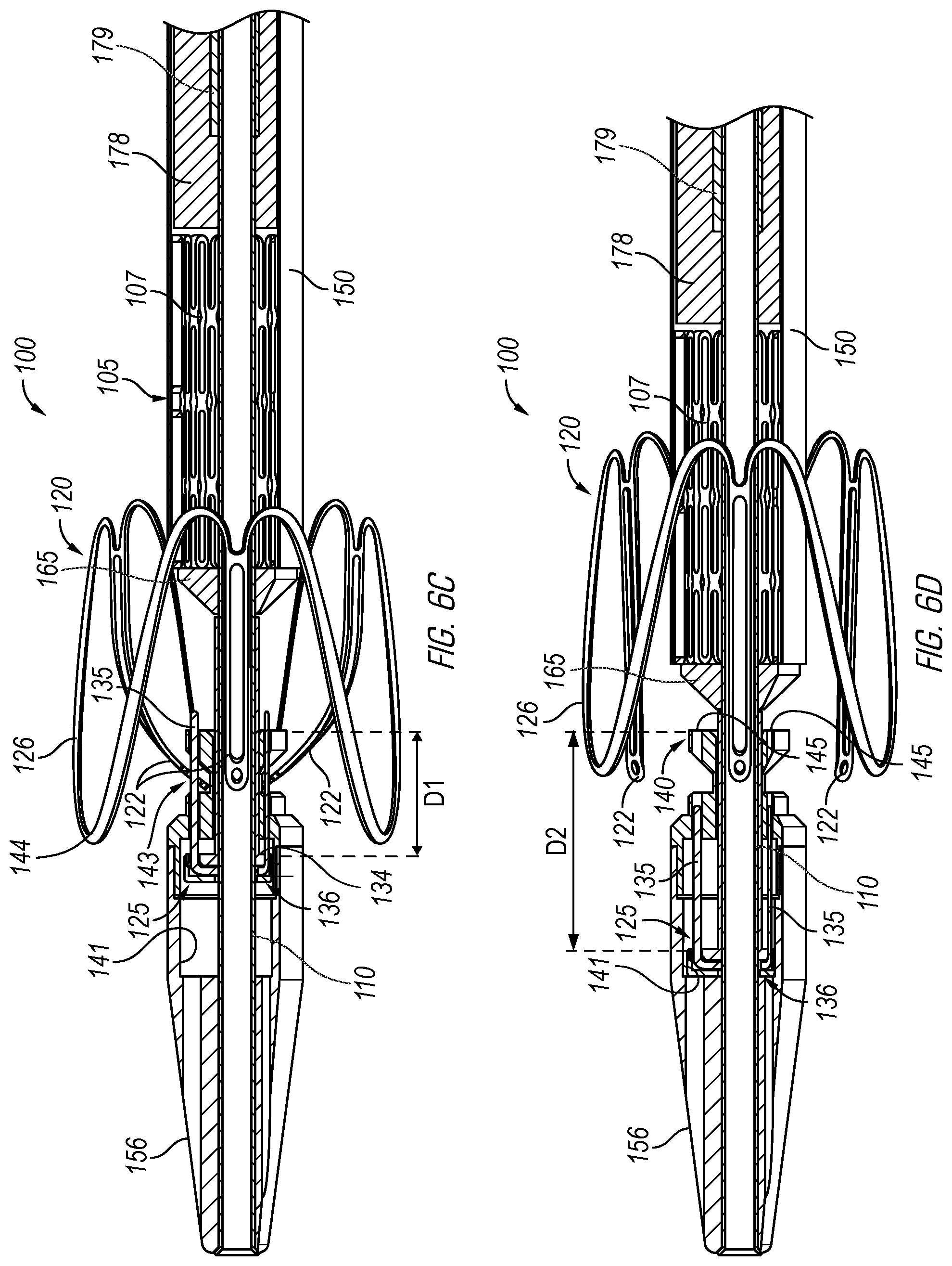 Patent US12376962 Figure 7 – Methods and devices for delivery of a prosthetic valve