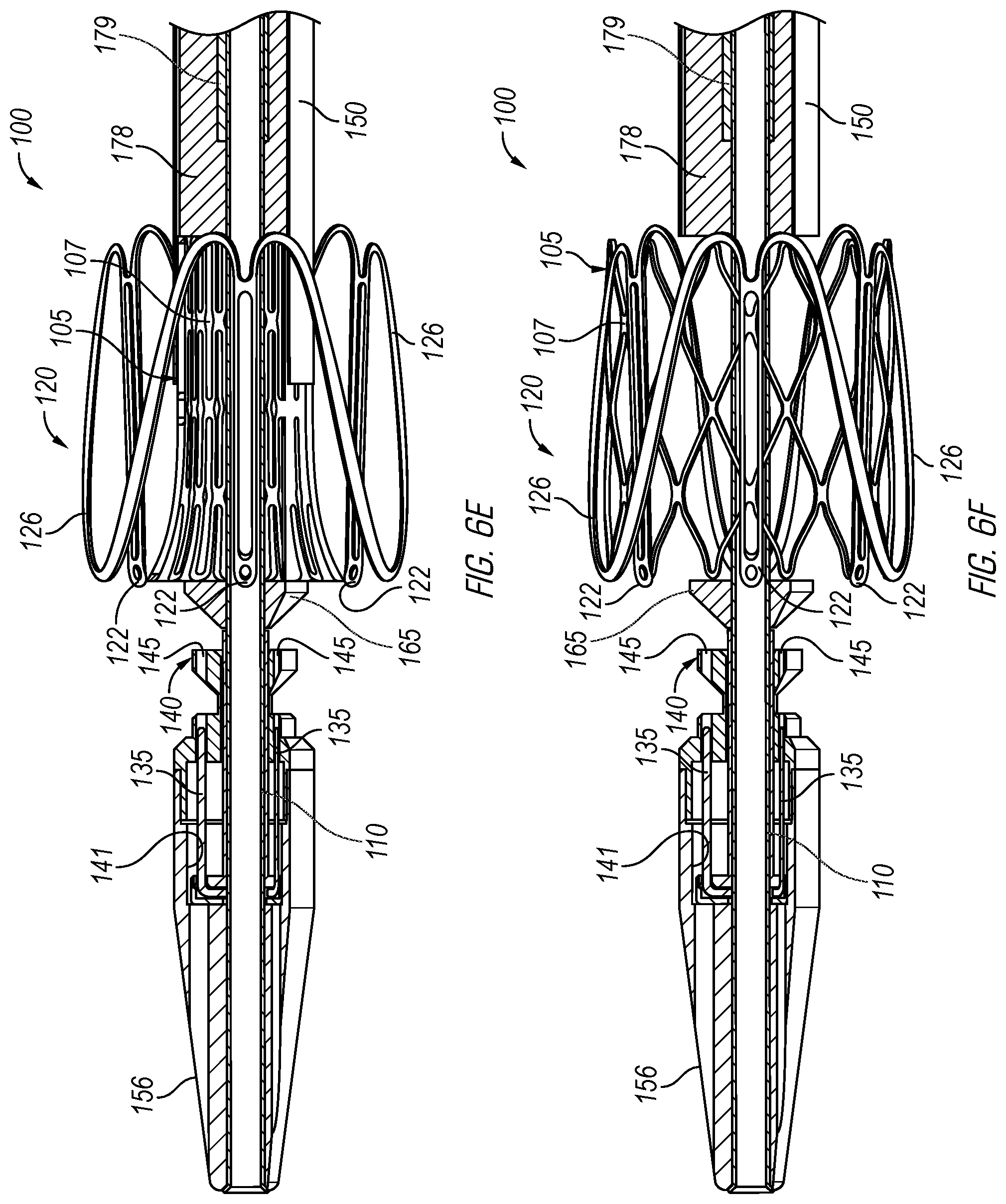 Patent US12376962 Figure 8 – Methods and devices for delivery of a prosthetic valve
