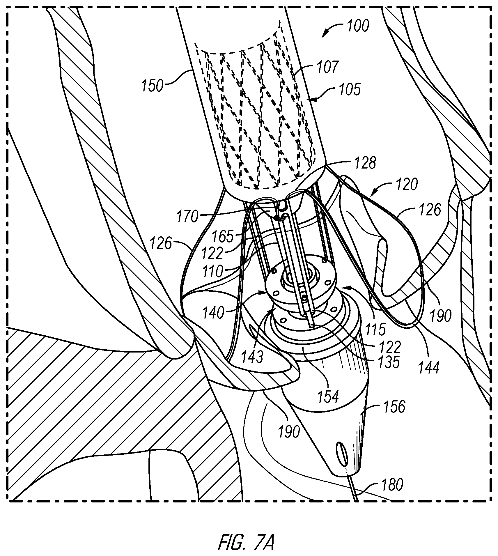 Patent US12376962 Figure 9 – Methods and devices for delivery of a prosthetic valve