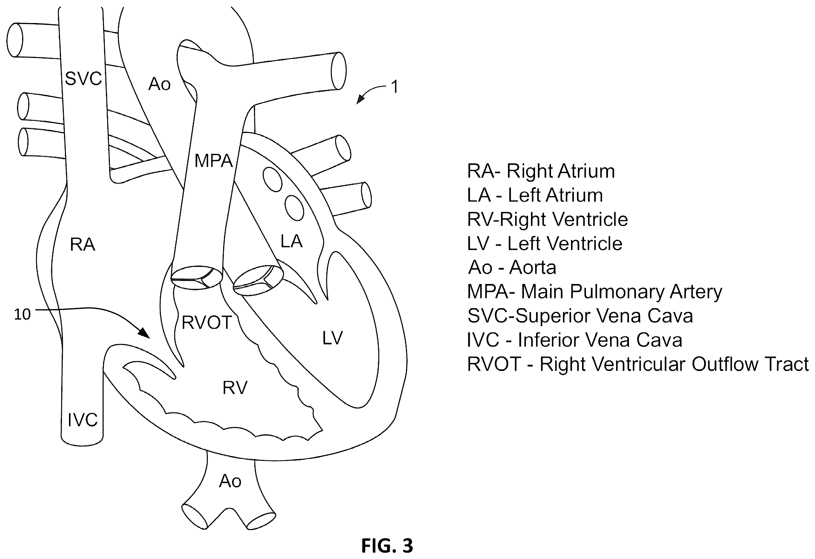 Patent US12376963 Figure 2 – Prosthetic heart valves