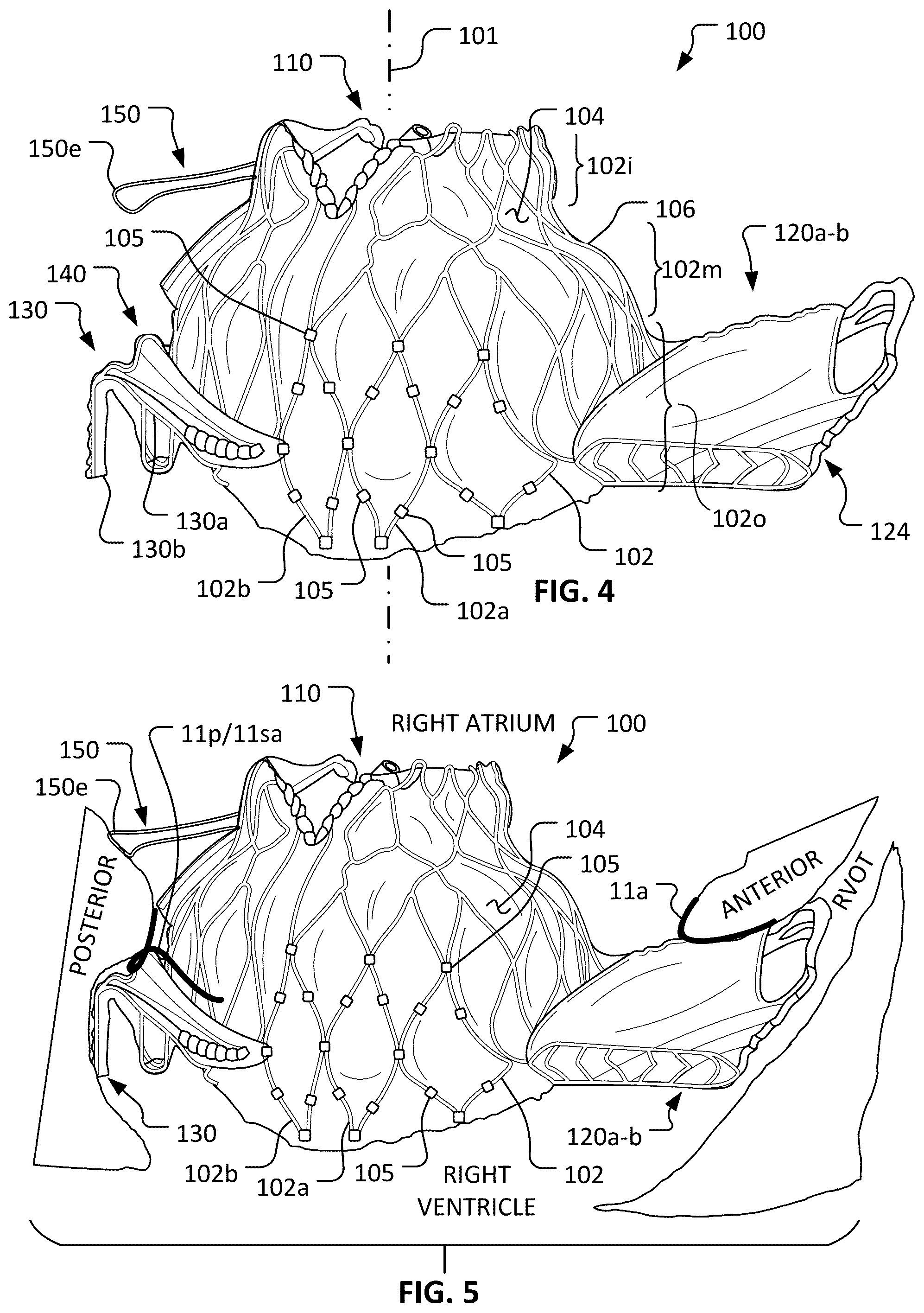 Patent US12376963 Figure 3 – Prosthetic heart valves