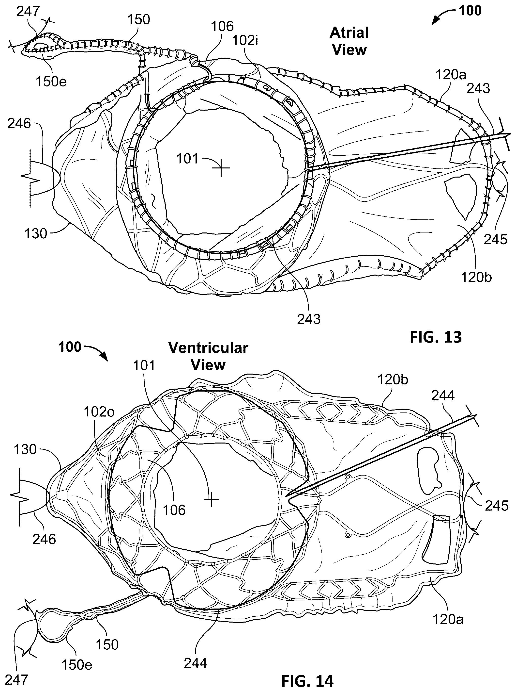 Patent US12376963 Figure 7 – Prosthetic heart valves