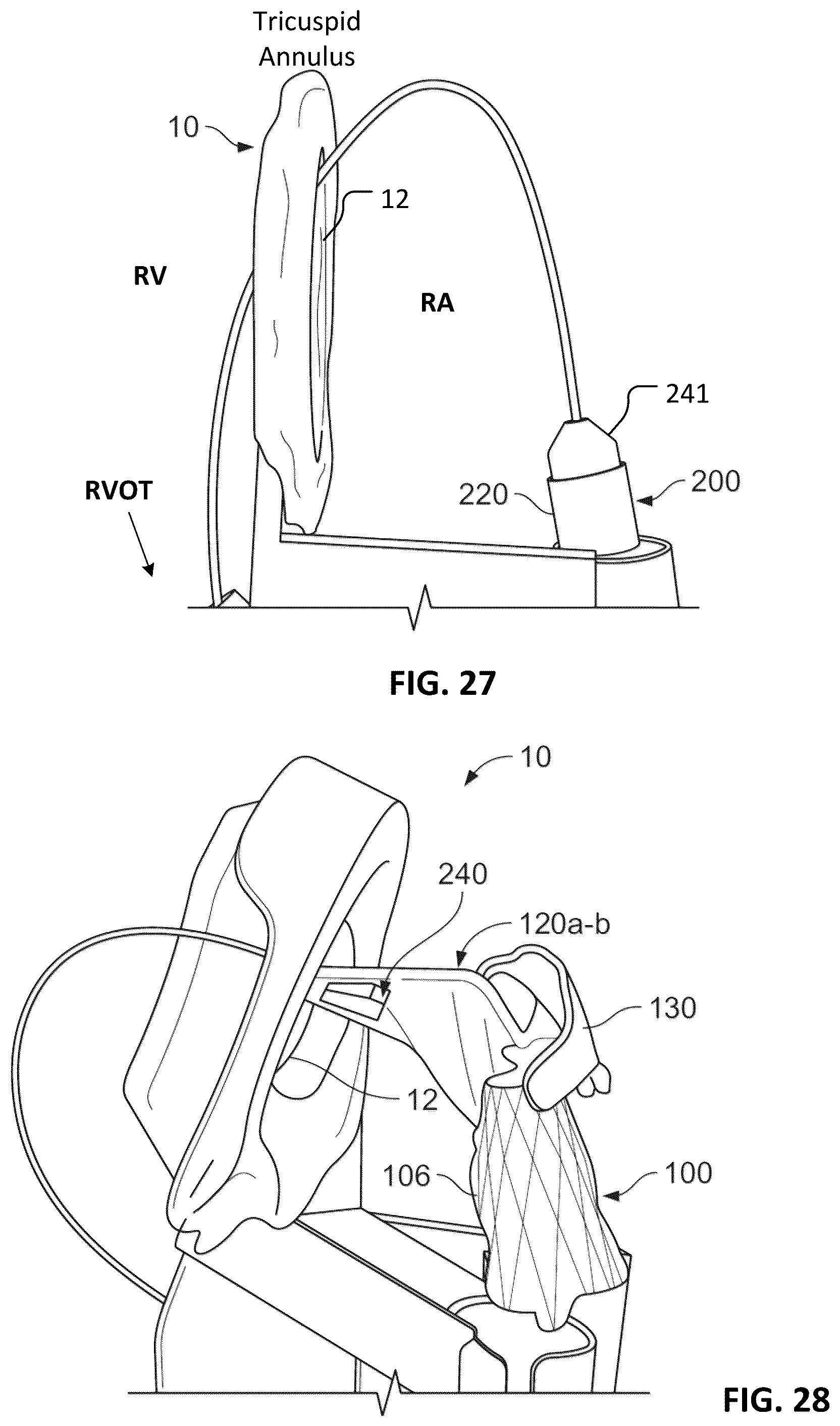 Patent US12376963 Figure 13 – Prosthetic heart valves