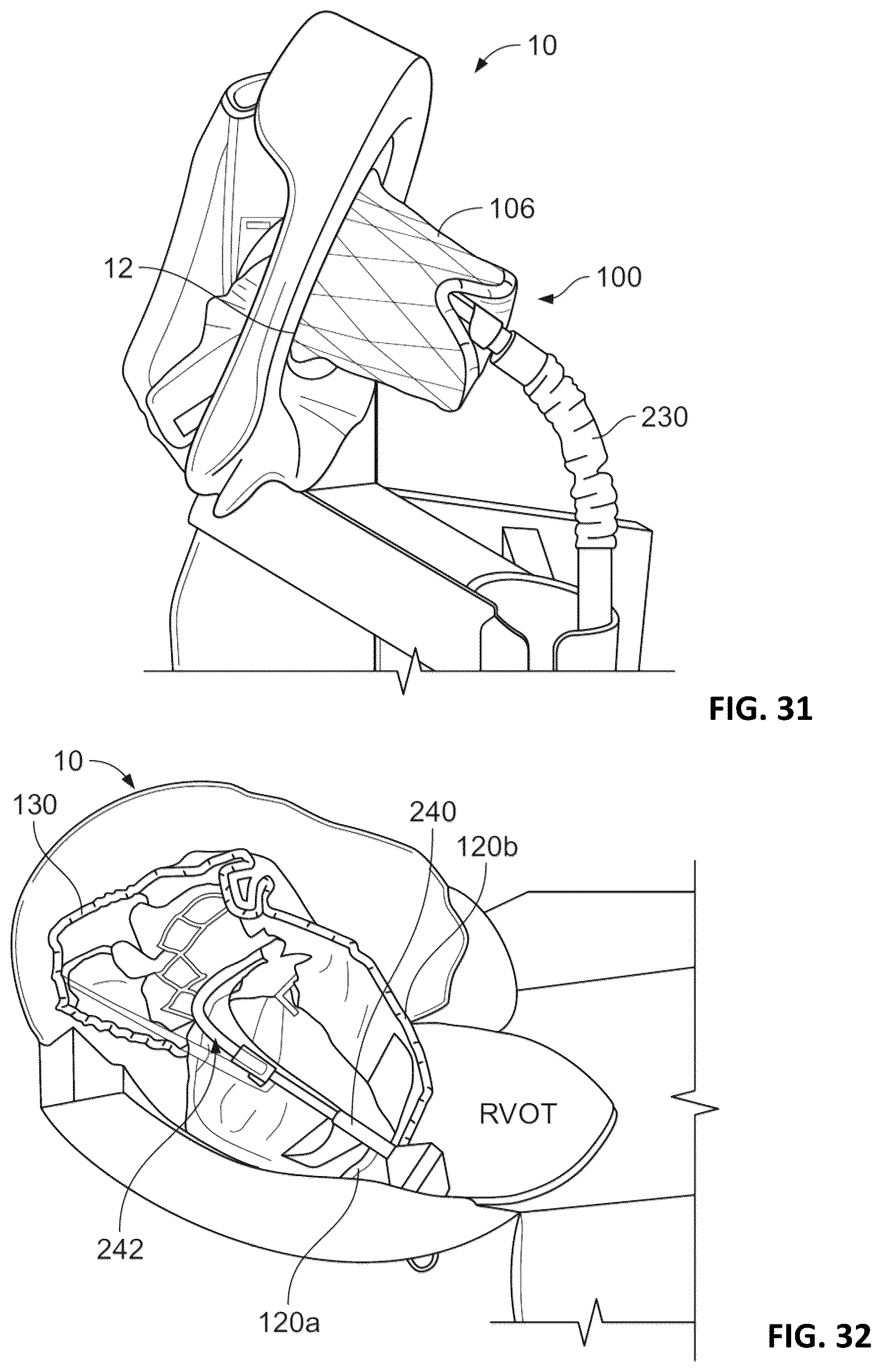 Patent US12376963 Figure 15 – Prosthetic heart valves