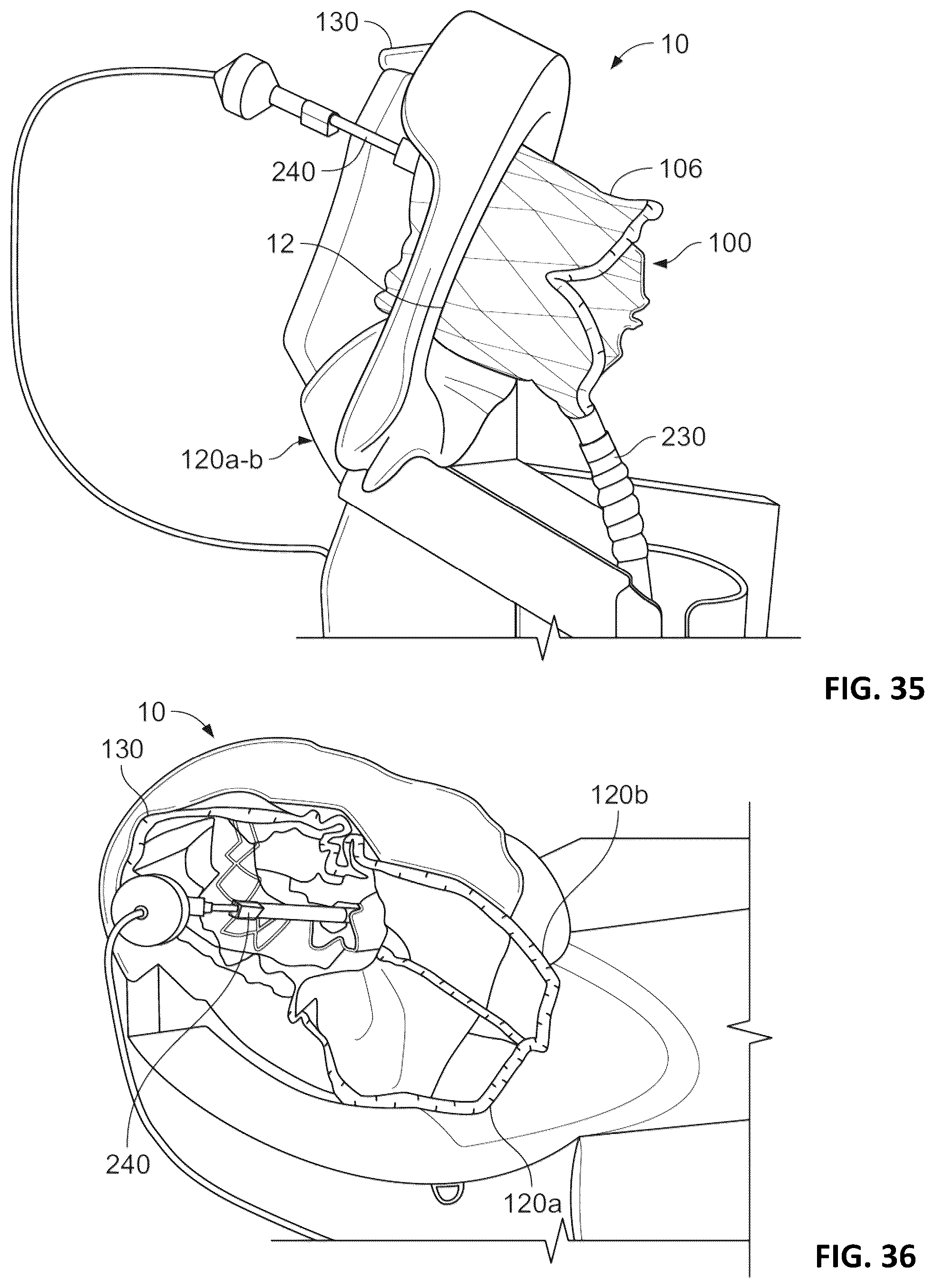 Patent US12376963 Figure 17 – Prosthetic heart valves