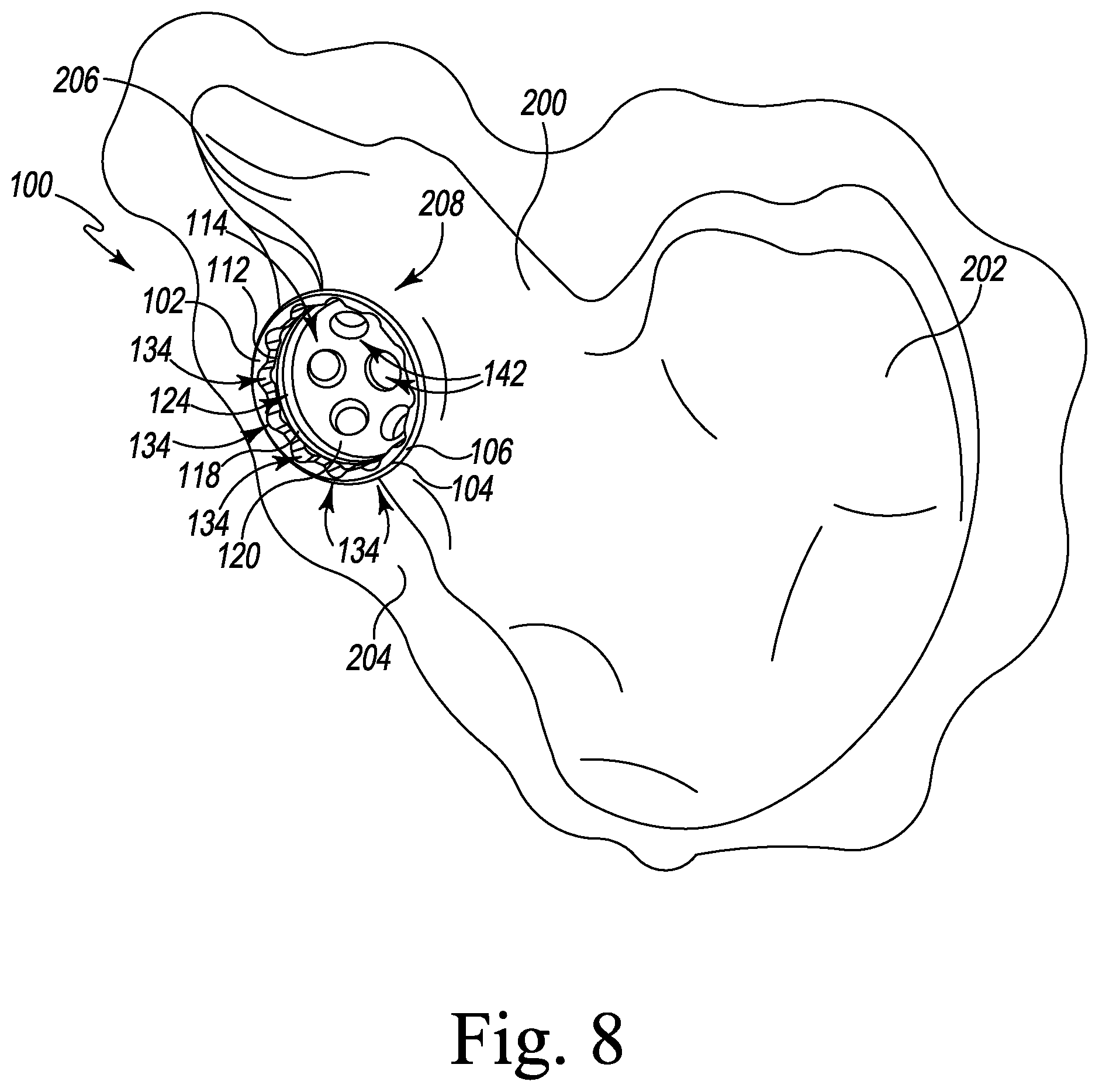 Patent US12376964 Figure 8 – Apparatus and method for locking an acetabular liner to an acetabular cup