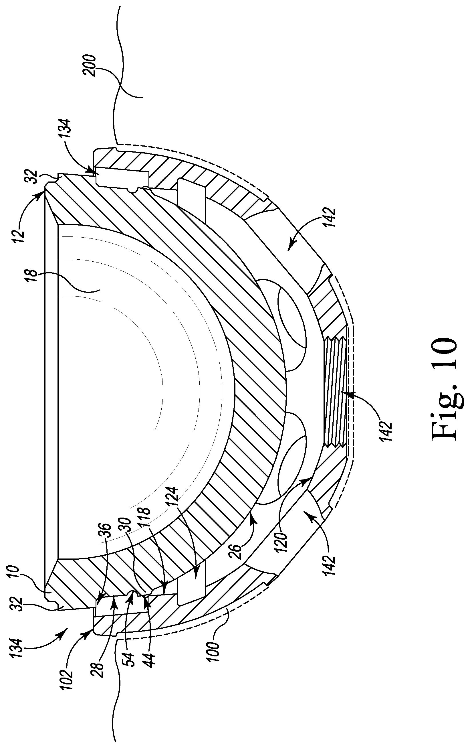 Patent US12376964 Figure 10 – Apparatus and method for locking an acetabular liner to an acetabular cup