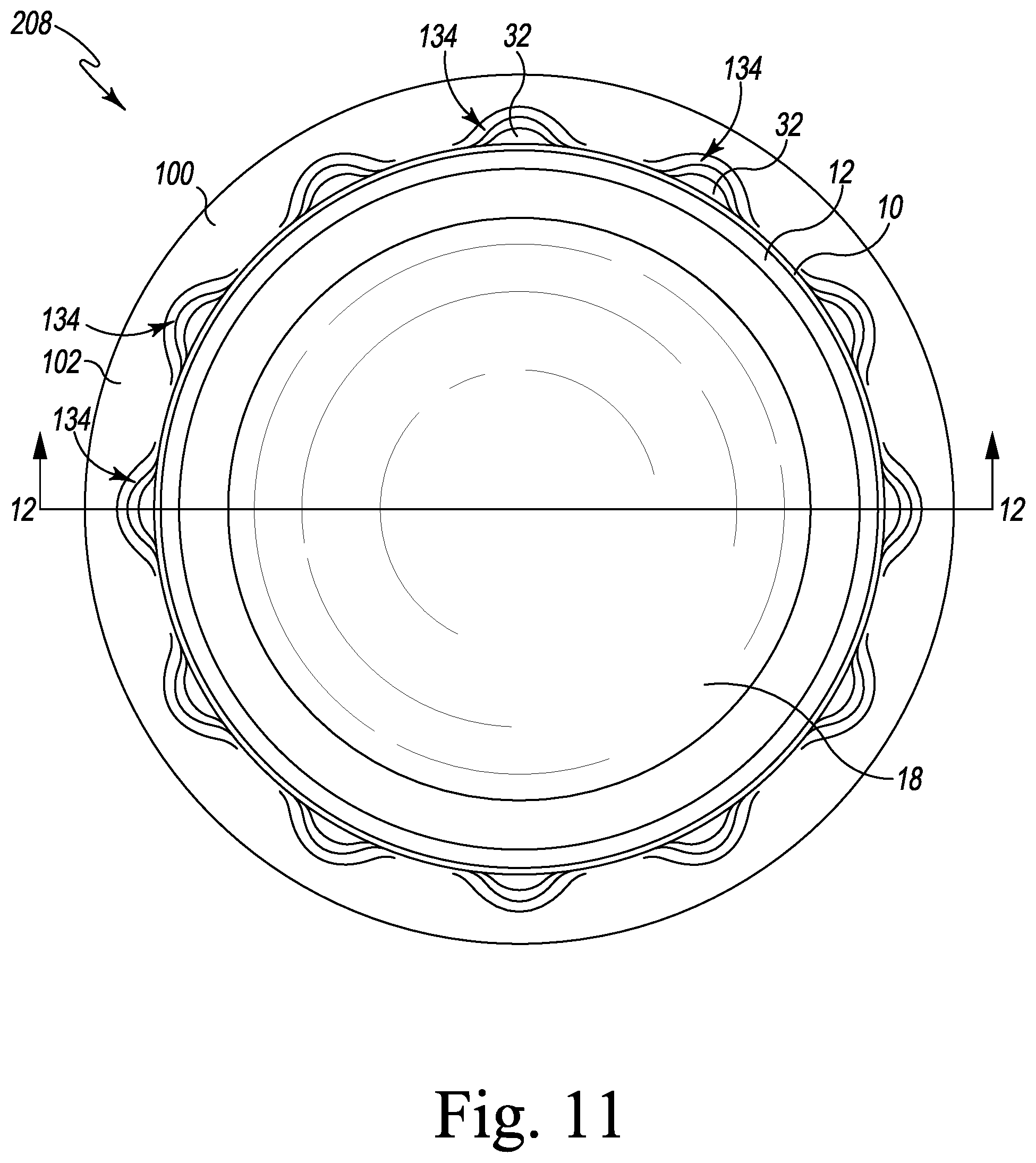 Patent US12376964 Figure 11 – Apparatus and method for locking an acetabular liner to an acetabular cup
