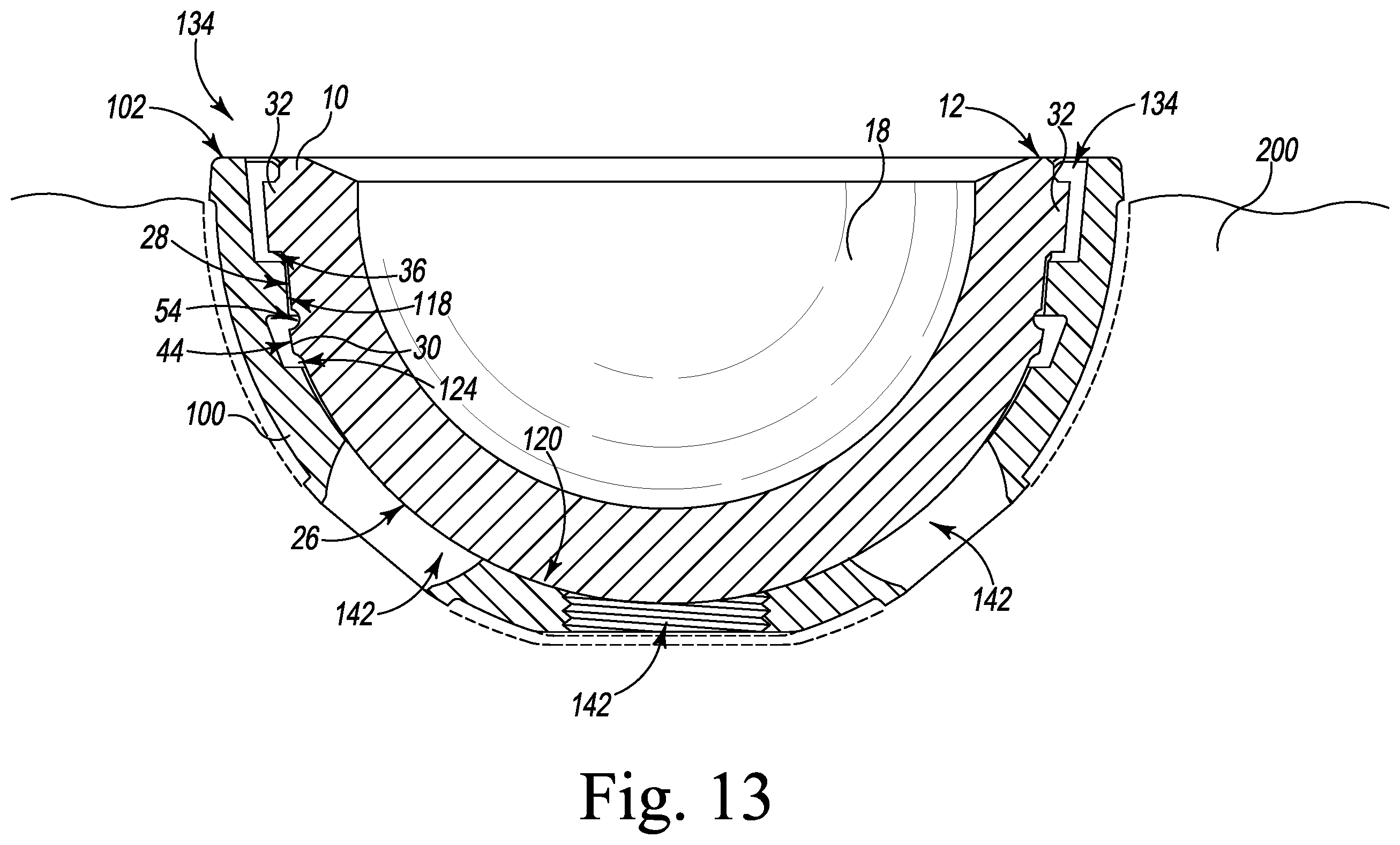 Patent US12376964 Figure 13 – Apparatus and method for locking an acetabular liner to an acetabular cup