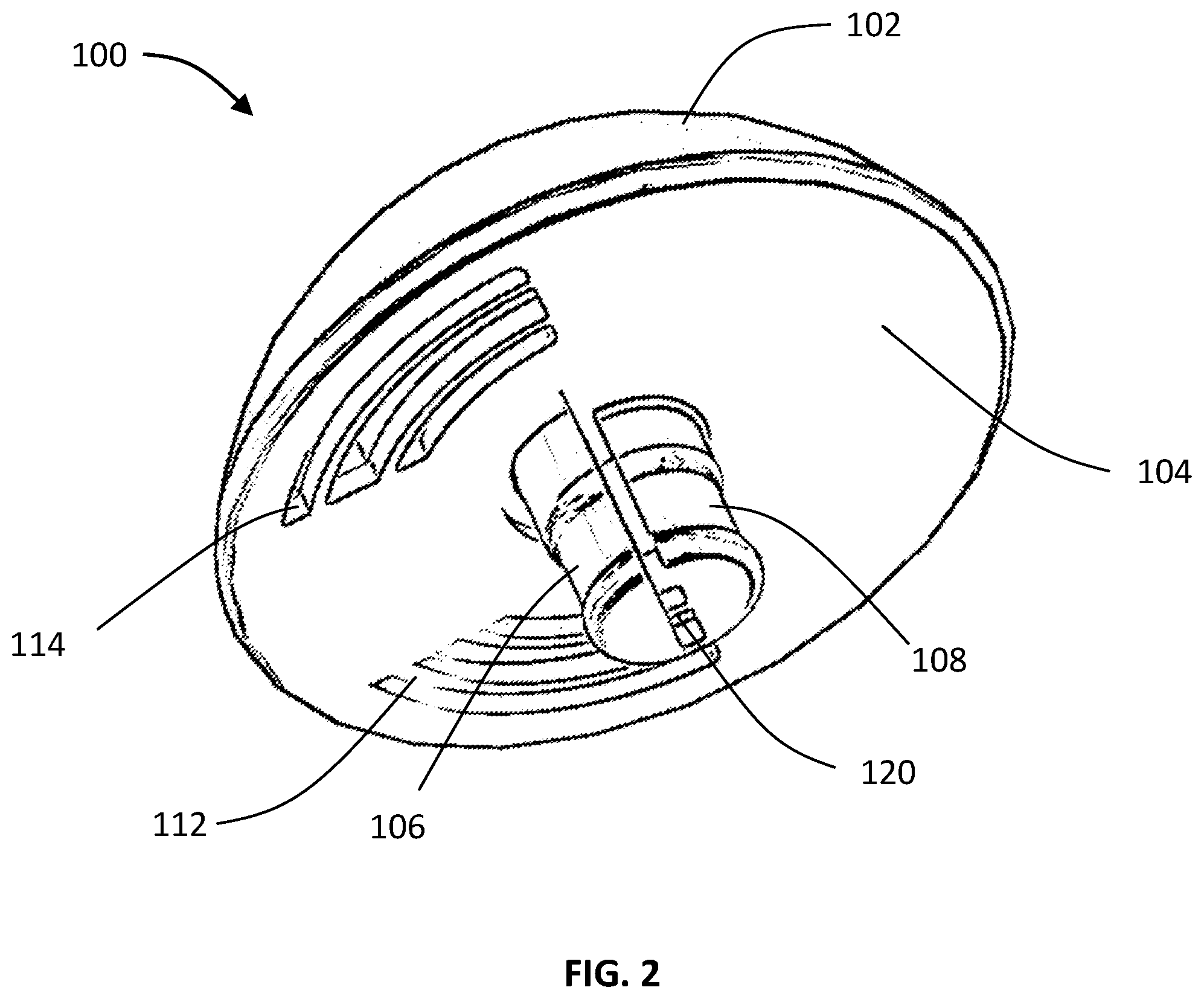 Patent US12376965 Figure 2 – Shoulder trial with flexure