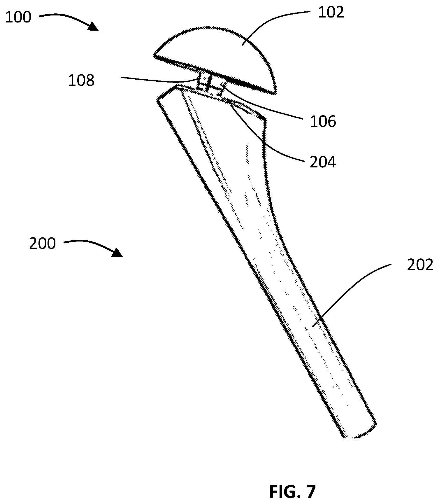 Patent US12376965 Figure 7 – Shoulder trial with flexure
