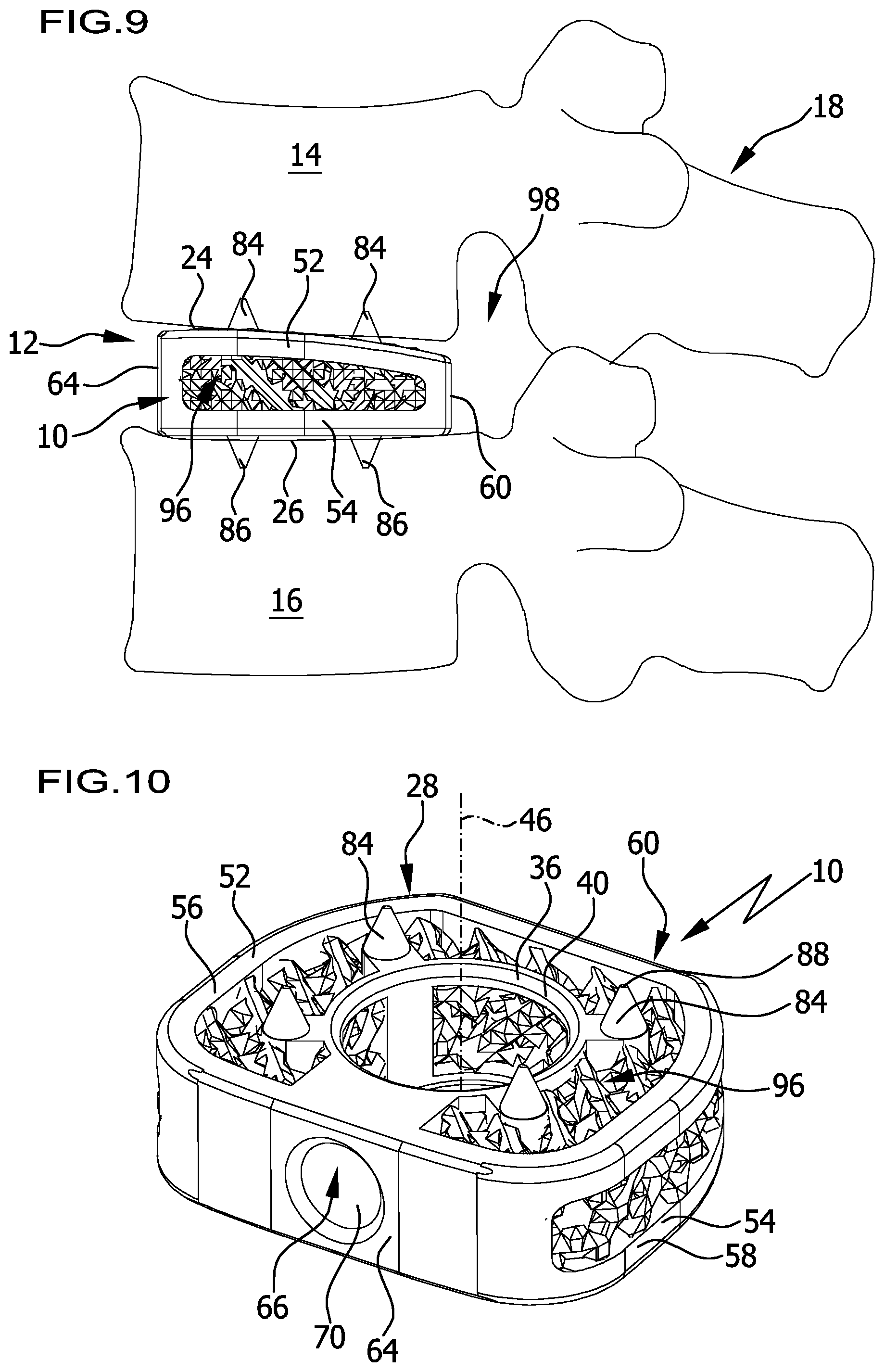 Patent US12376966 Figure 6 – Intervertebral implant
