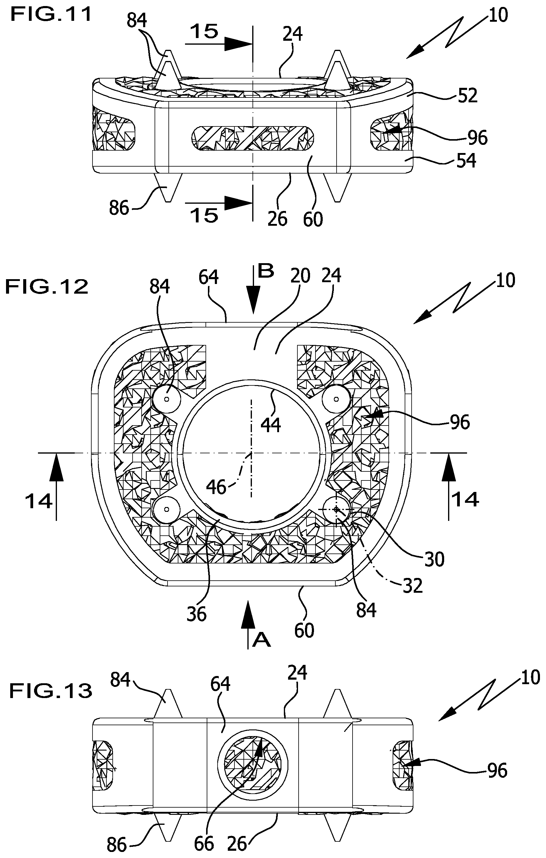 Patent US12376966 Figure 7 – Intervertebral implant