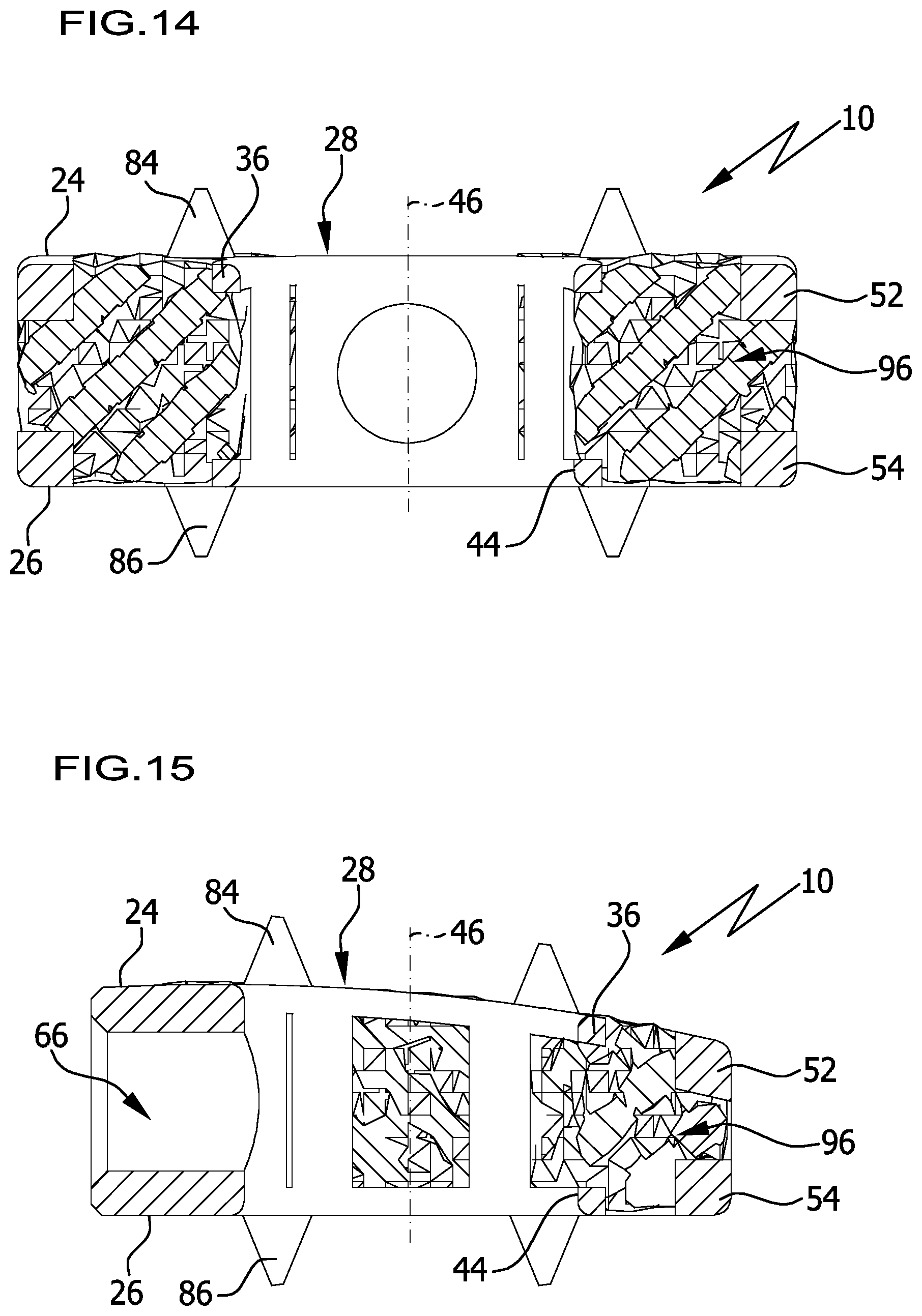 Patent US12376966 Figure 8 – Intervertebral implant