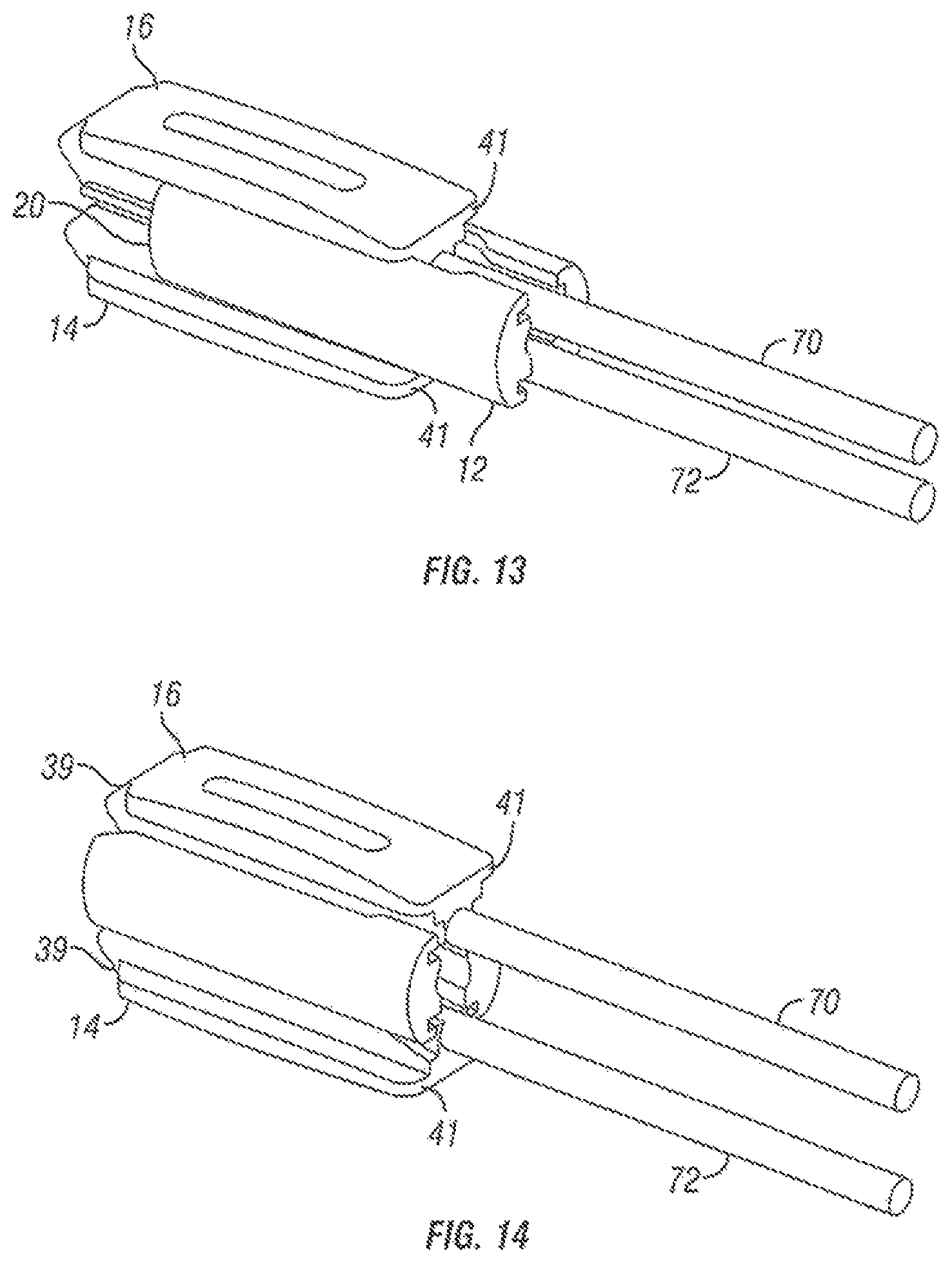 Patent US12376967 Figure 7 – Expandable fusion device and method of installation thereof