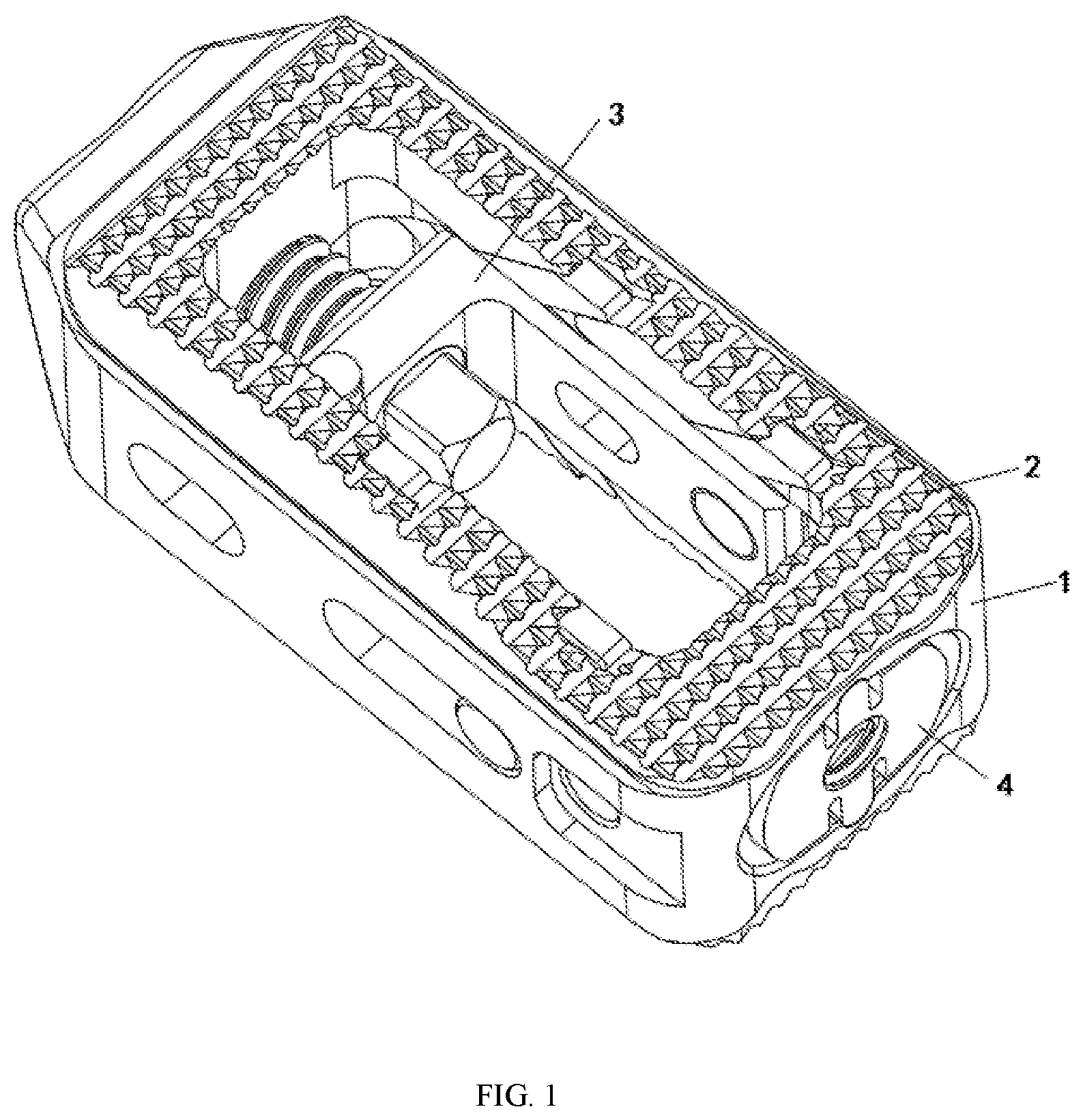 Patent US12376968 Figure 1 – Post-bone-grafting expandable cage