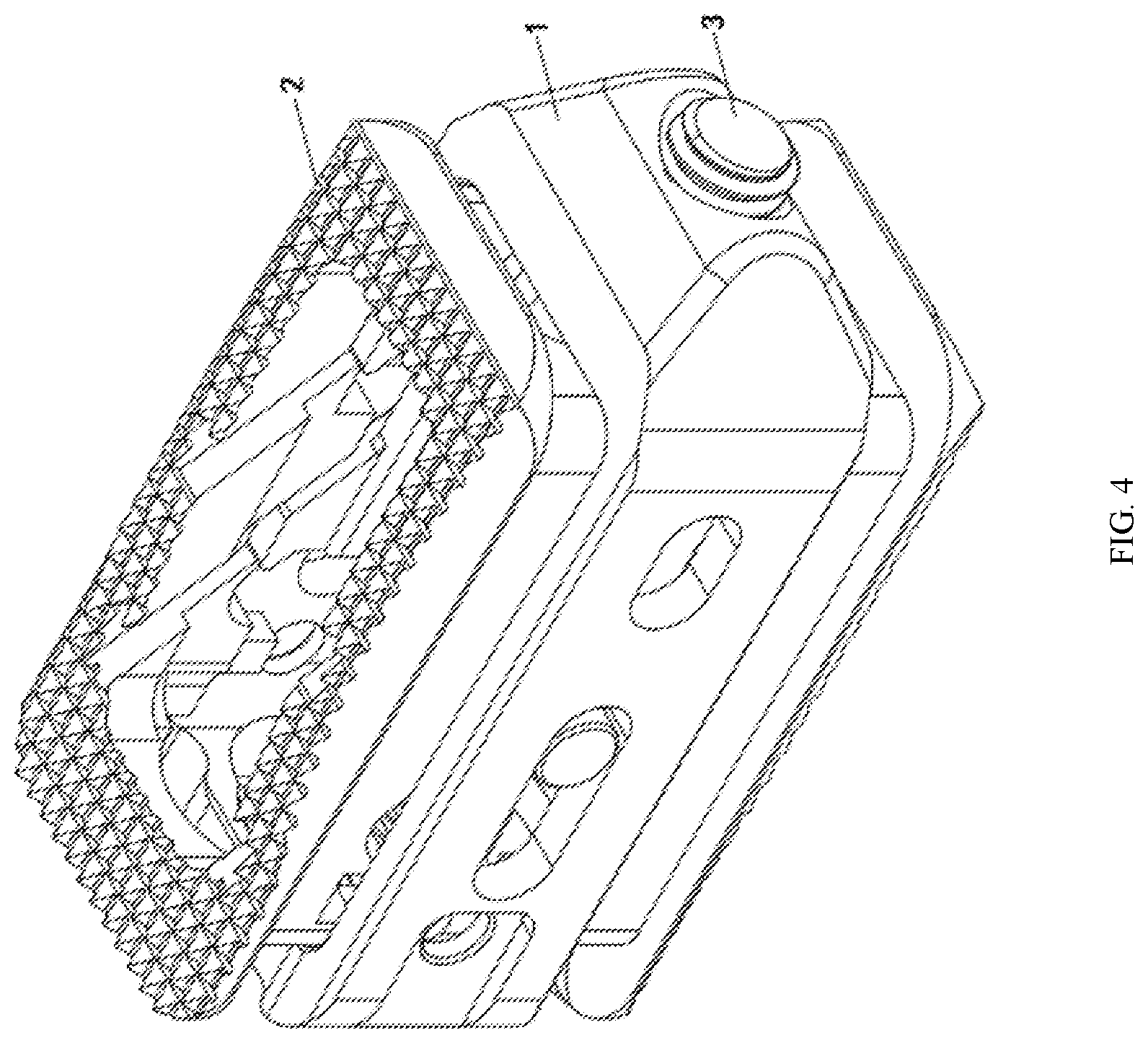 Patent US12376968 Figure 4 – Post-bone-grafting expandable cage