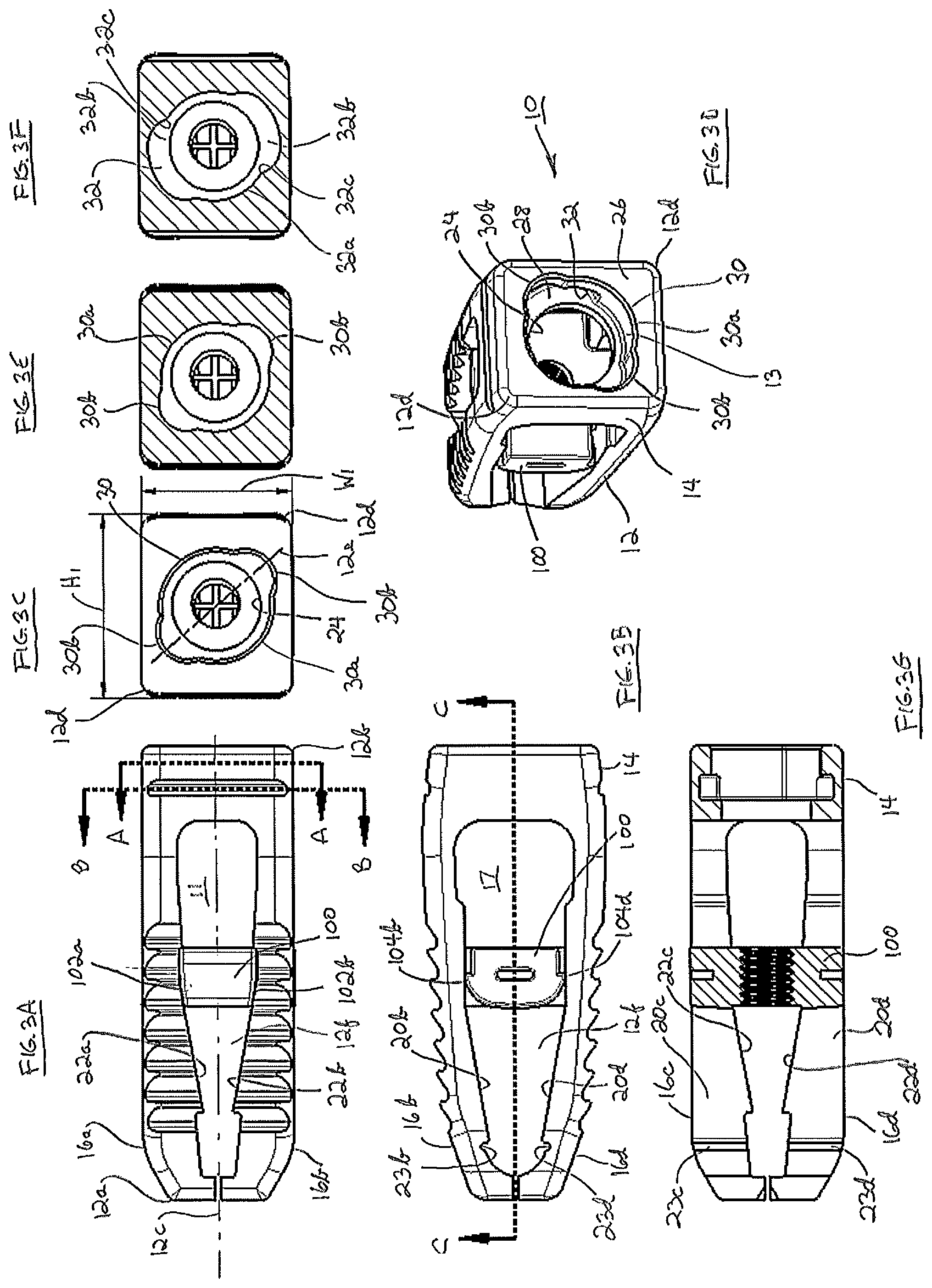 Patent US12376969 Figure 3 – Interbody fusion device comprising textured surfaces