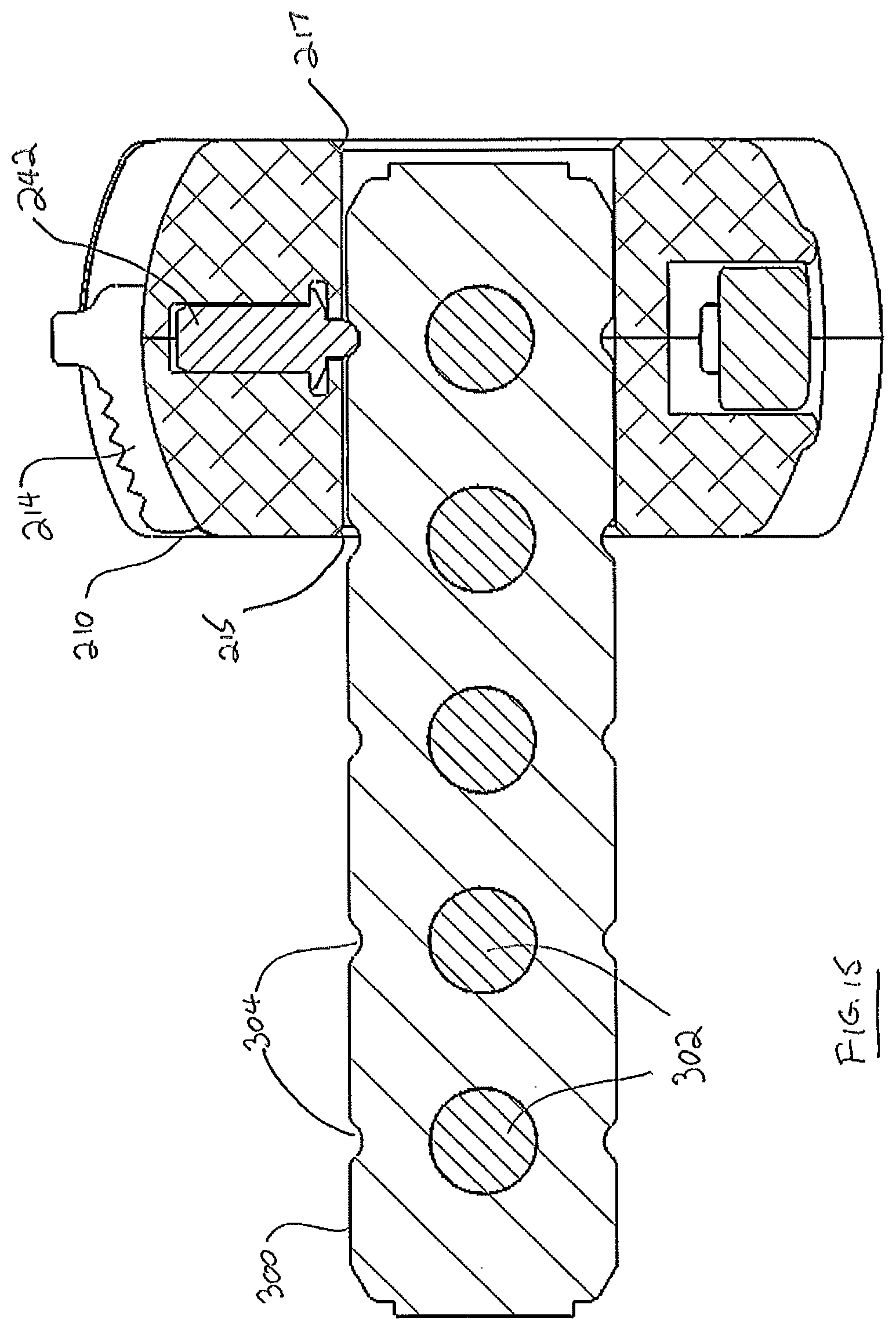 Patent US12376969 Figure 15 – Interbody fusion device comprising textured surfaces