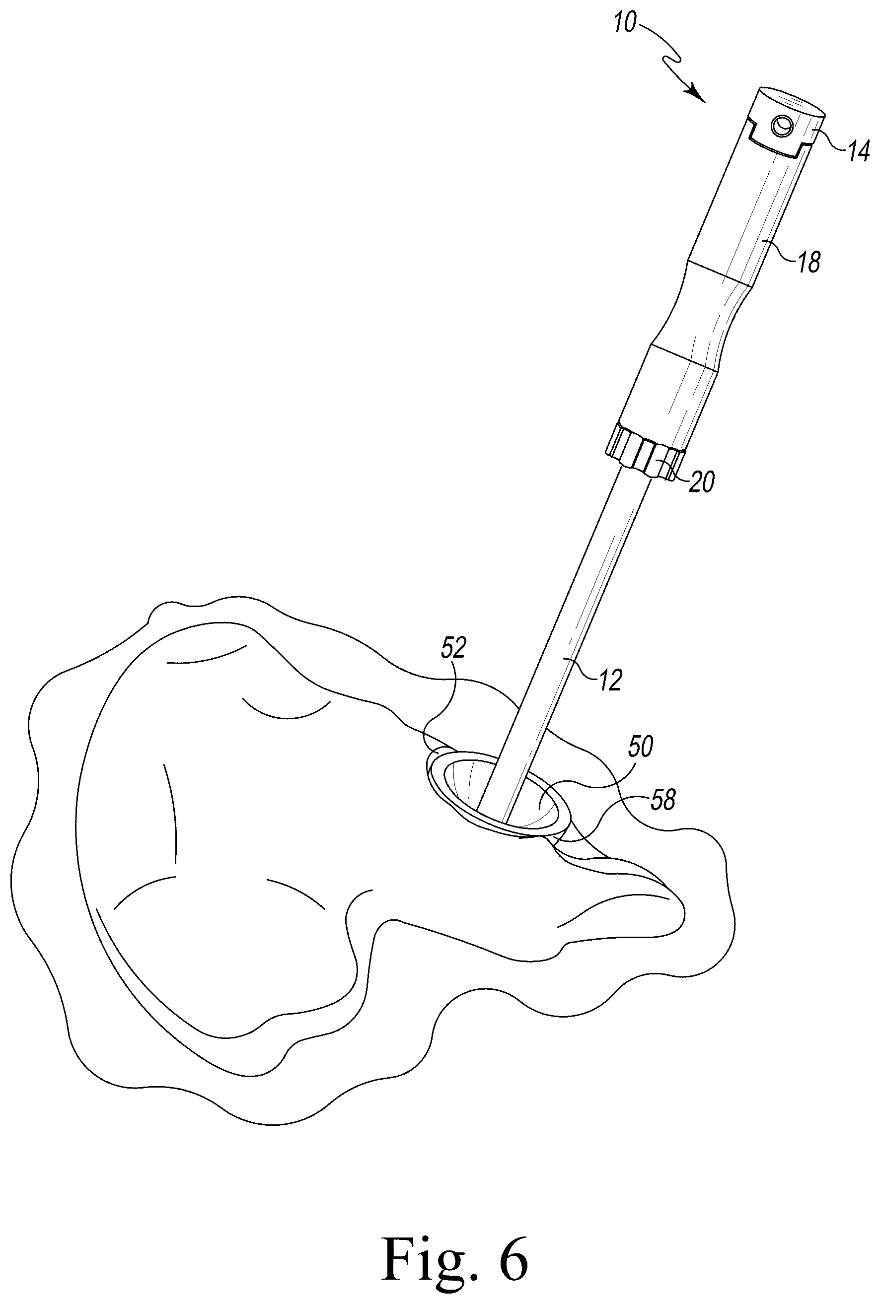 Patent US12376970 Figure 5 – Implant insertion tool for implanting an acetabular component and associated surgical method