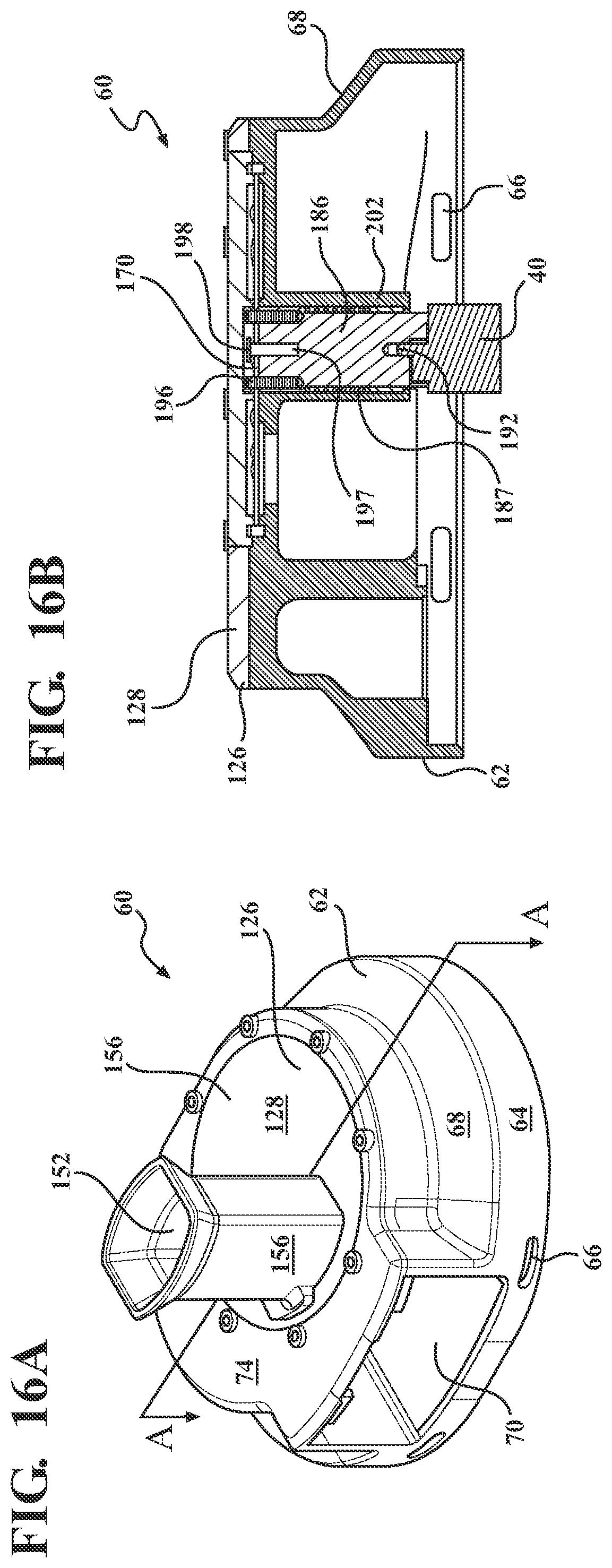 Patent US12376971 Figure 10 – Bone mill with an accessible milling element