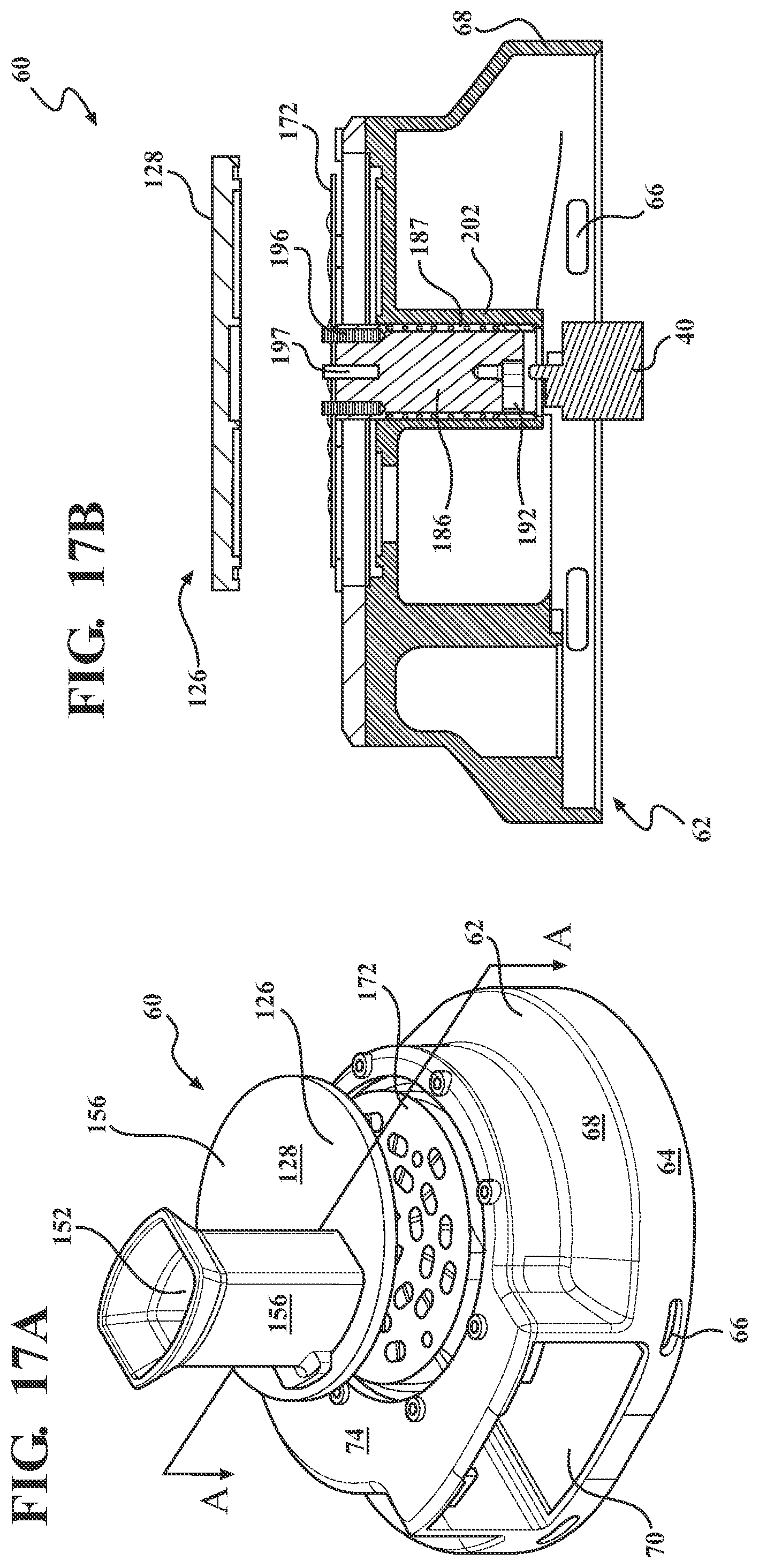 Patent US12376971 Figure 11 – Bone mill with an accessible milling element