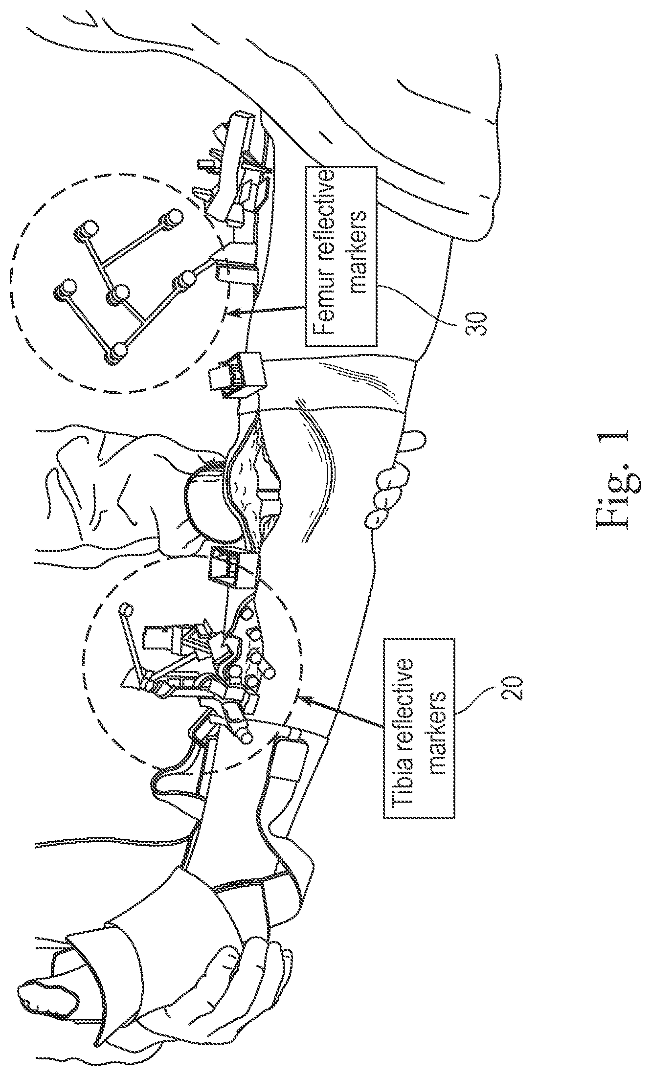Patent US12376973 Figure 1 – System and method for quantifying gap assessment examination