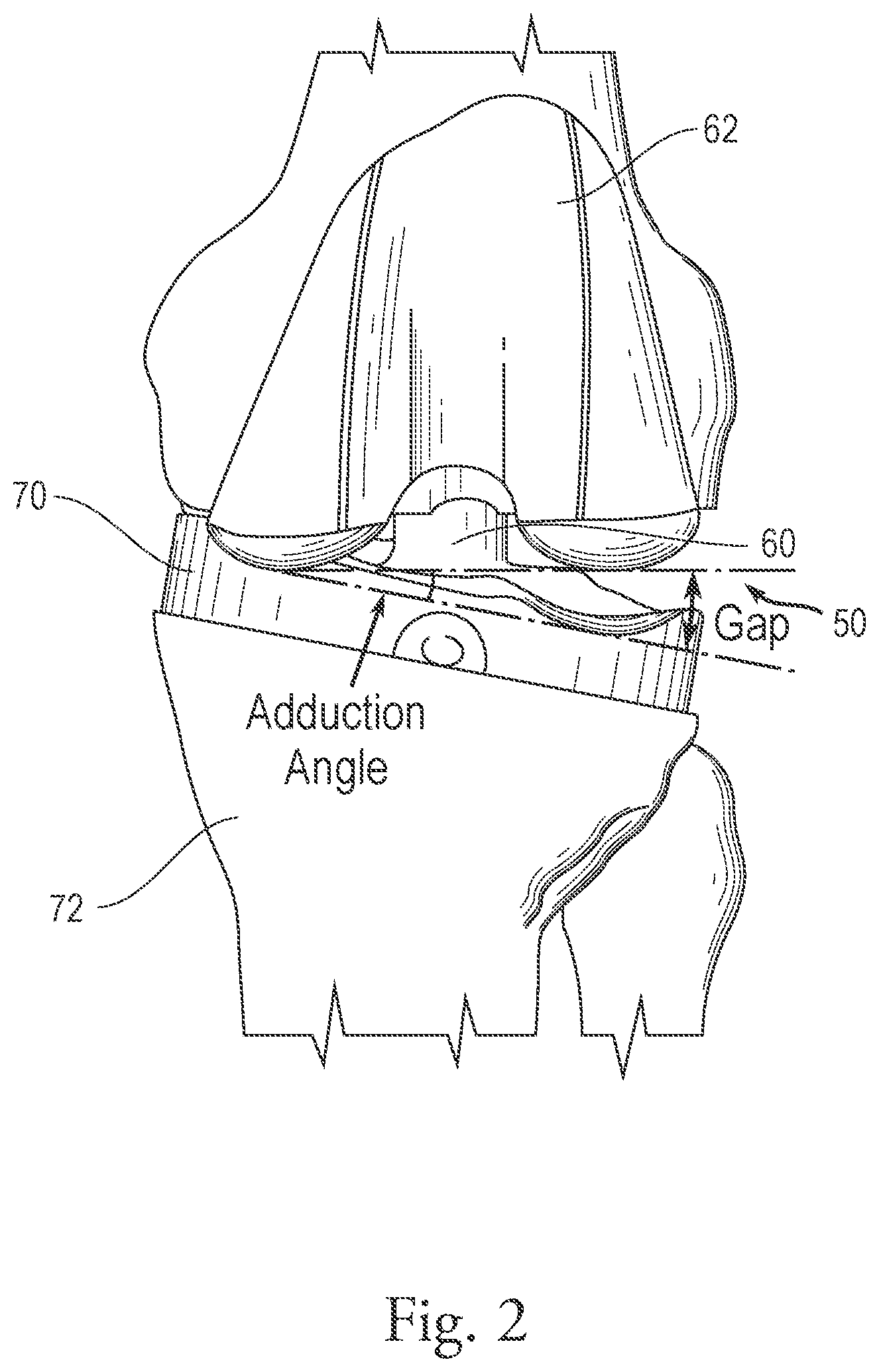 Patent US12376973 Figure 2 – System and method for quantifying gap assessment examination
