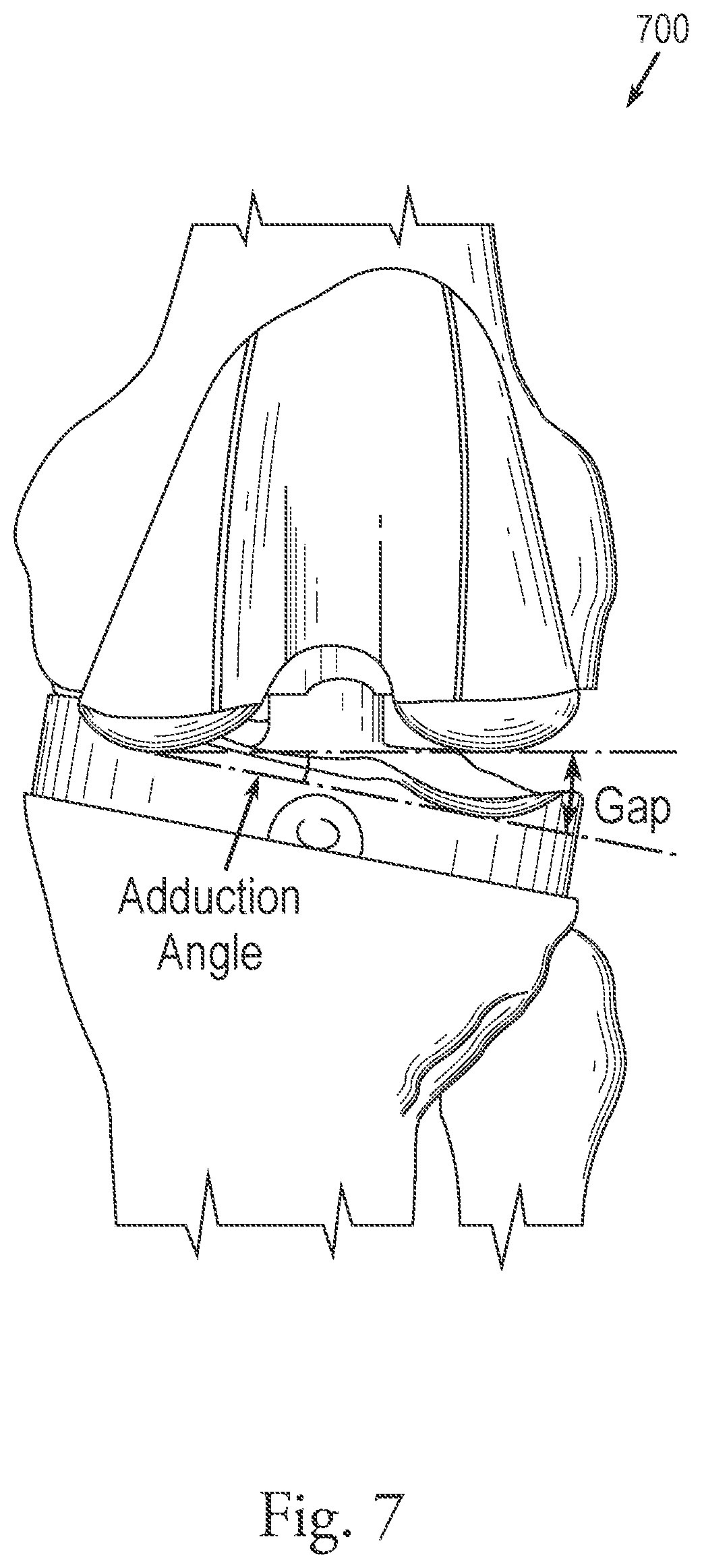 Patent US12376973 Figure 7 – System and method for quantifying gap assessment examination