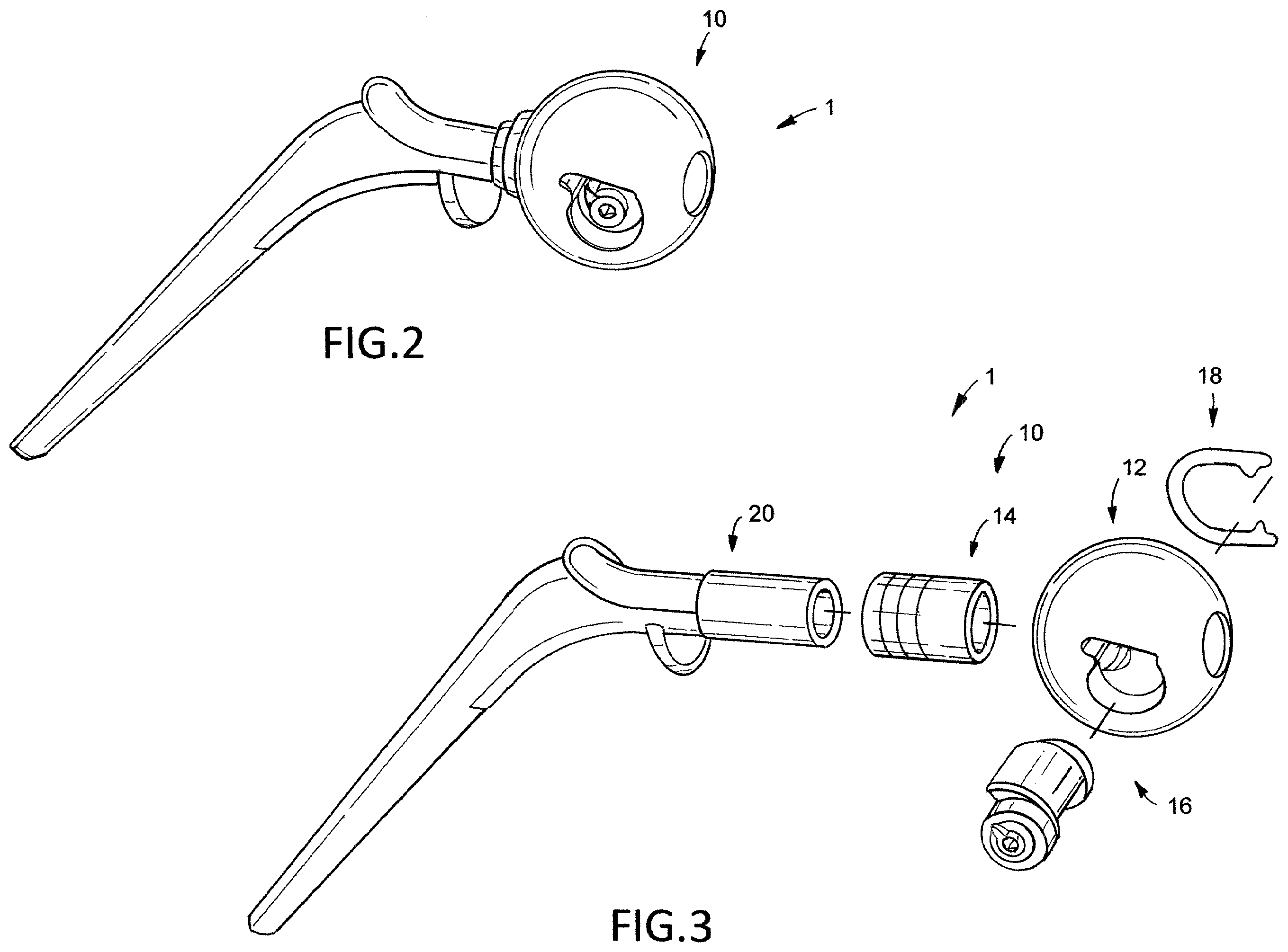 Patent US12376974 Figure 2 – Hip arthroplasty trial systems and associated medical devices, methods, and kits