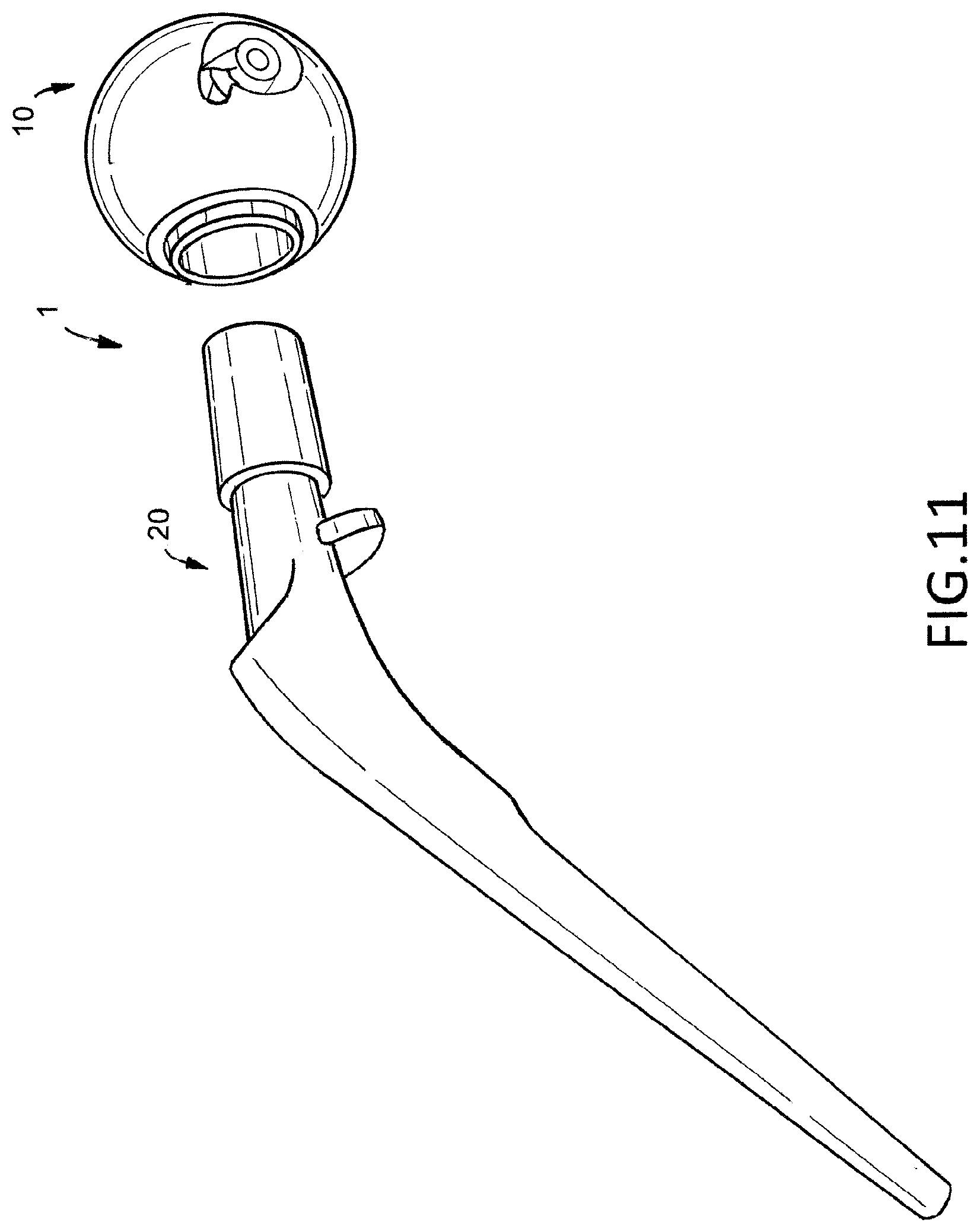 Patent US12376974 Figure 5 – Hip arthroplasty trial systems and associated medical devices, methods, and kits