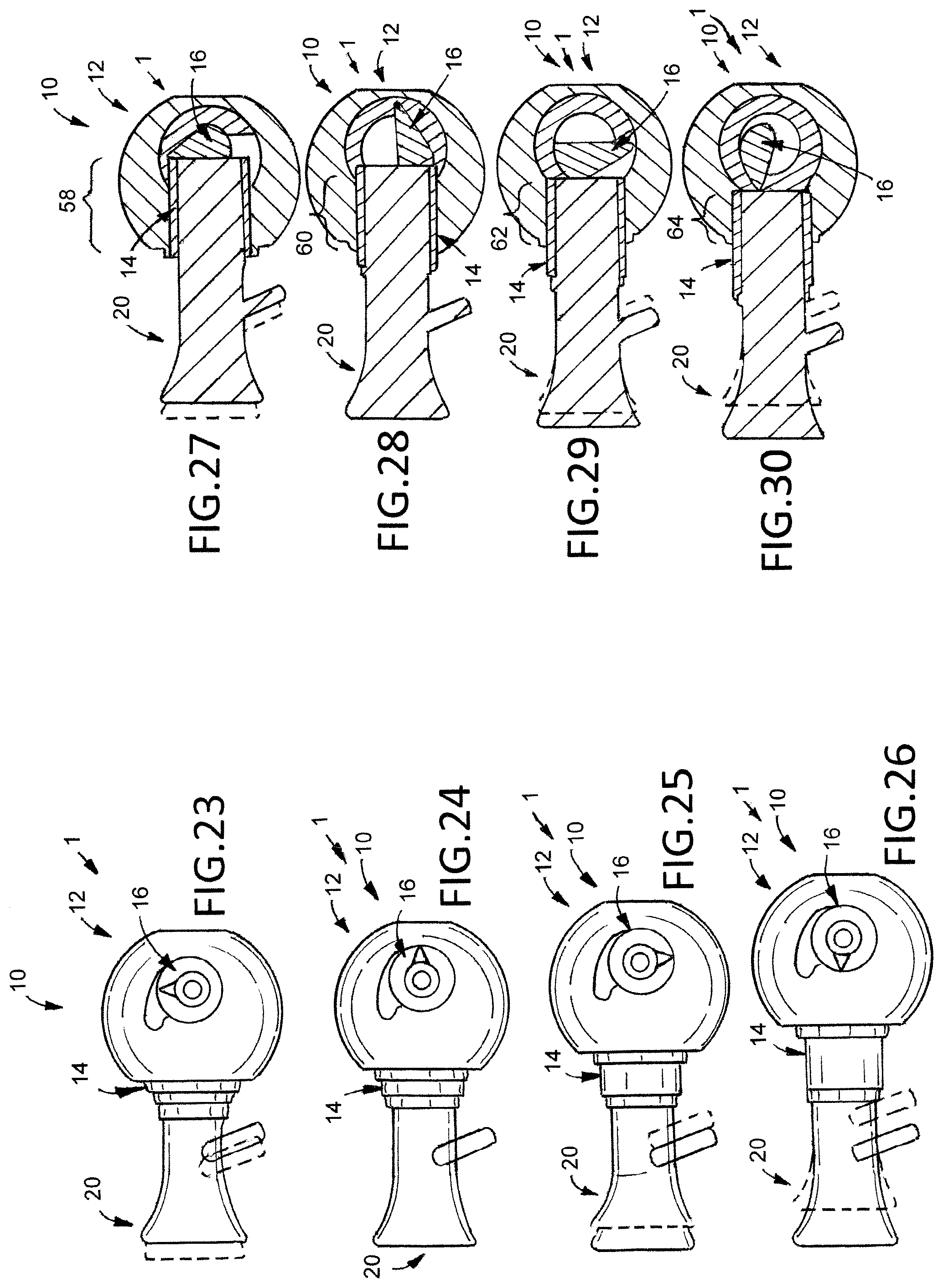 Patent US12376974 Figure 9 – Hip arthroplasty trial systems and associated medical devices, methods, and kits