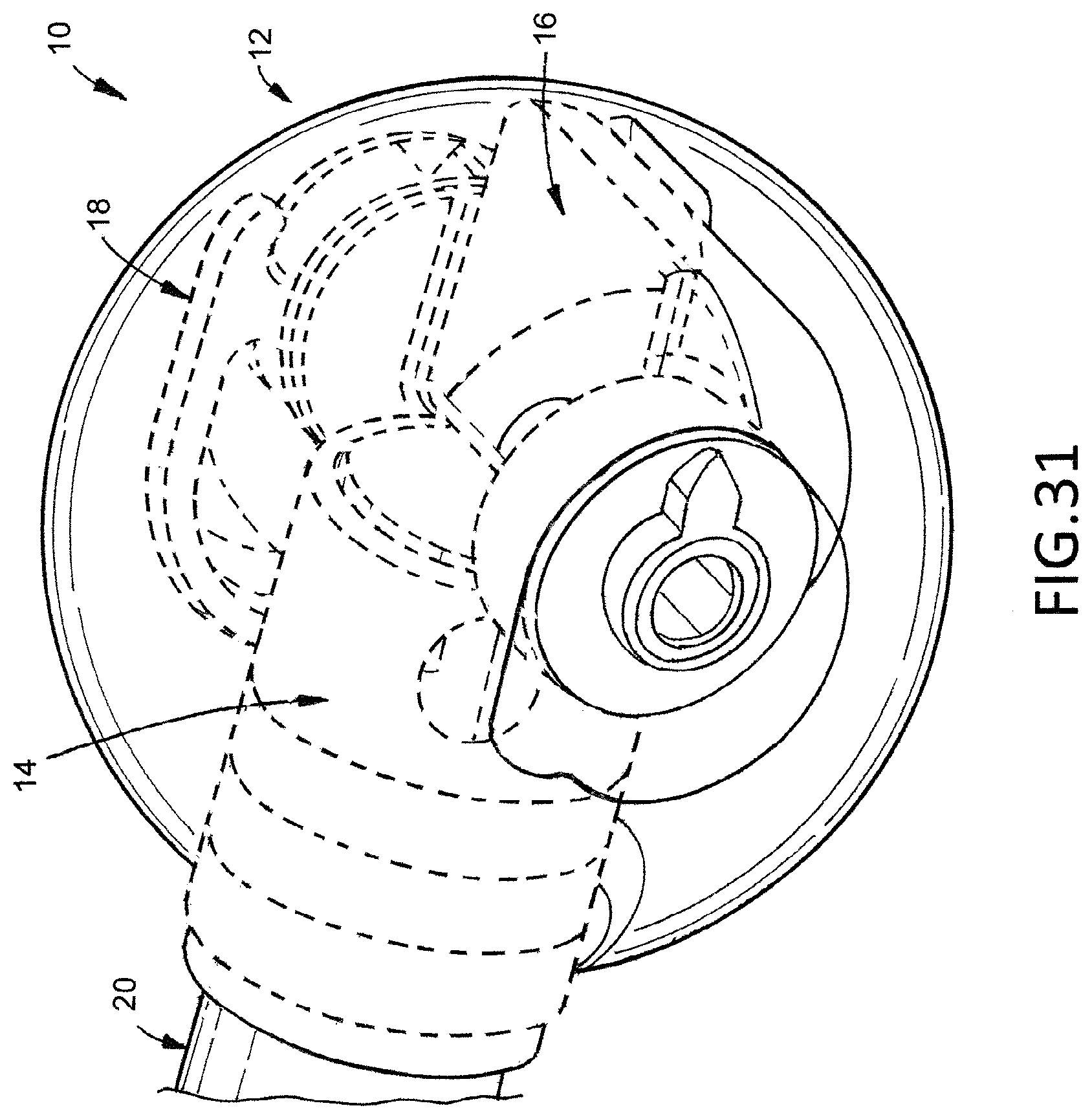 Patent US12376974 Figure 10 – Hip arthroplasty trial systems and associated medical devices, methods, and kits