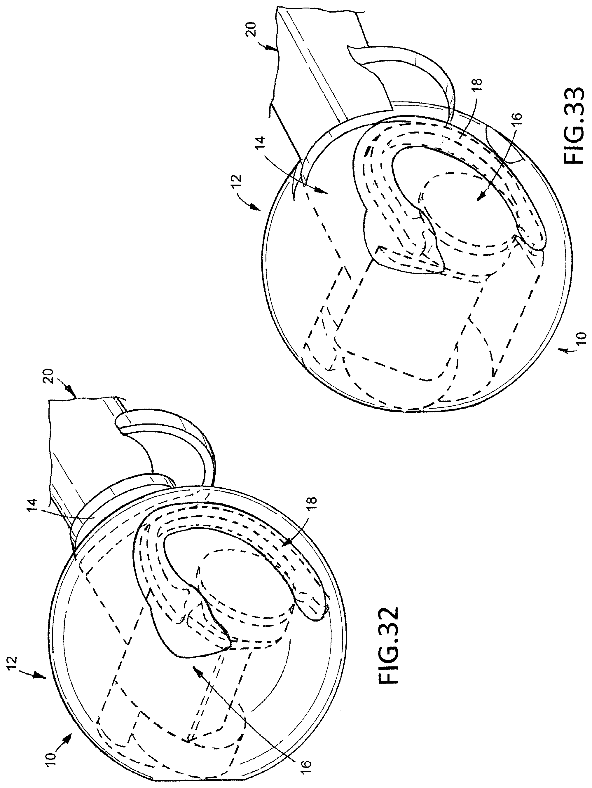 Patent US12376974 Figure 11 – Hip arthroplasty trial systems and associated medical devices, methods, and kits