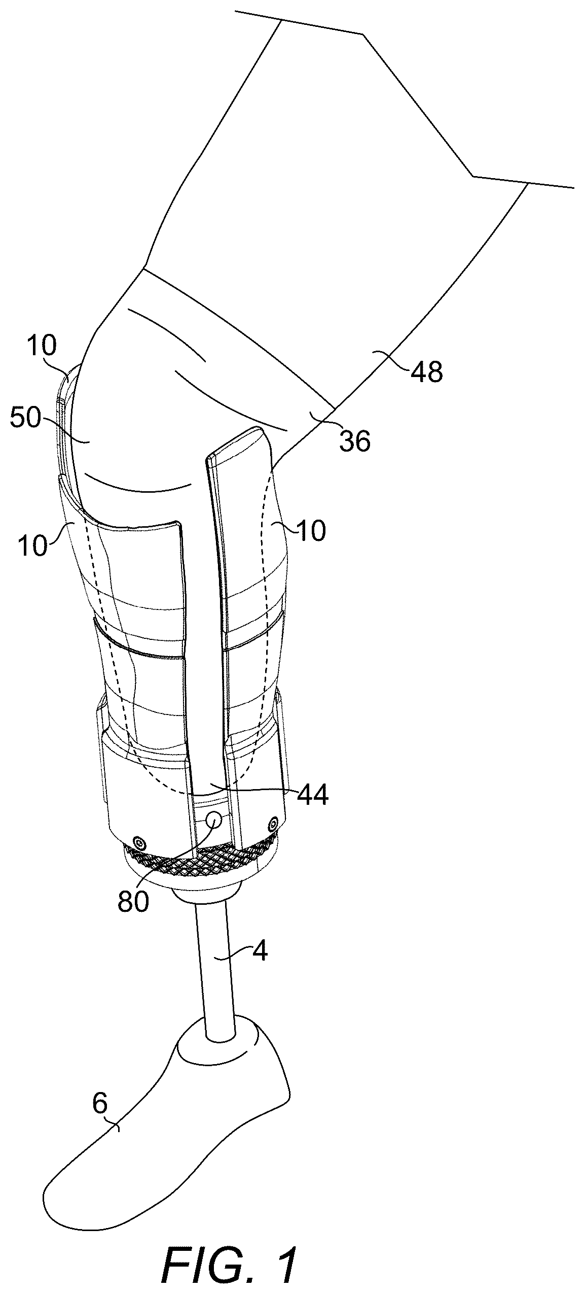 Patent US12376976 Figure 1 – Prosthetic socket