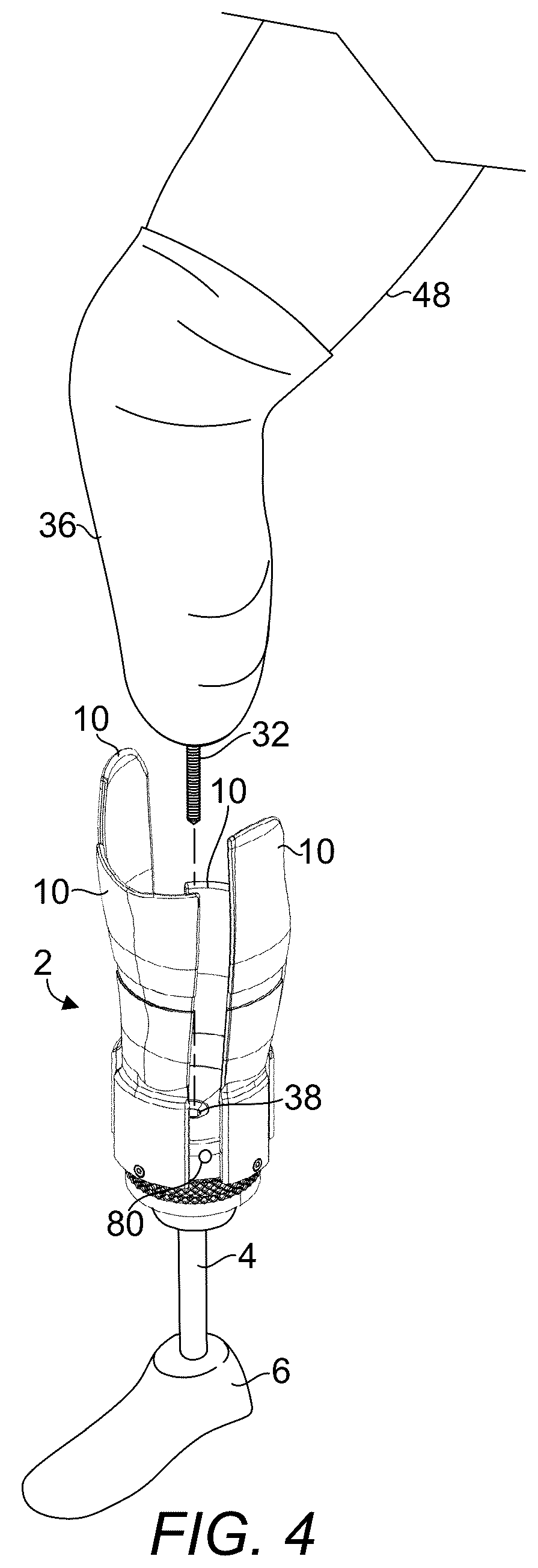 Patent US12376976 Figure 4 – Prosthetic socket