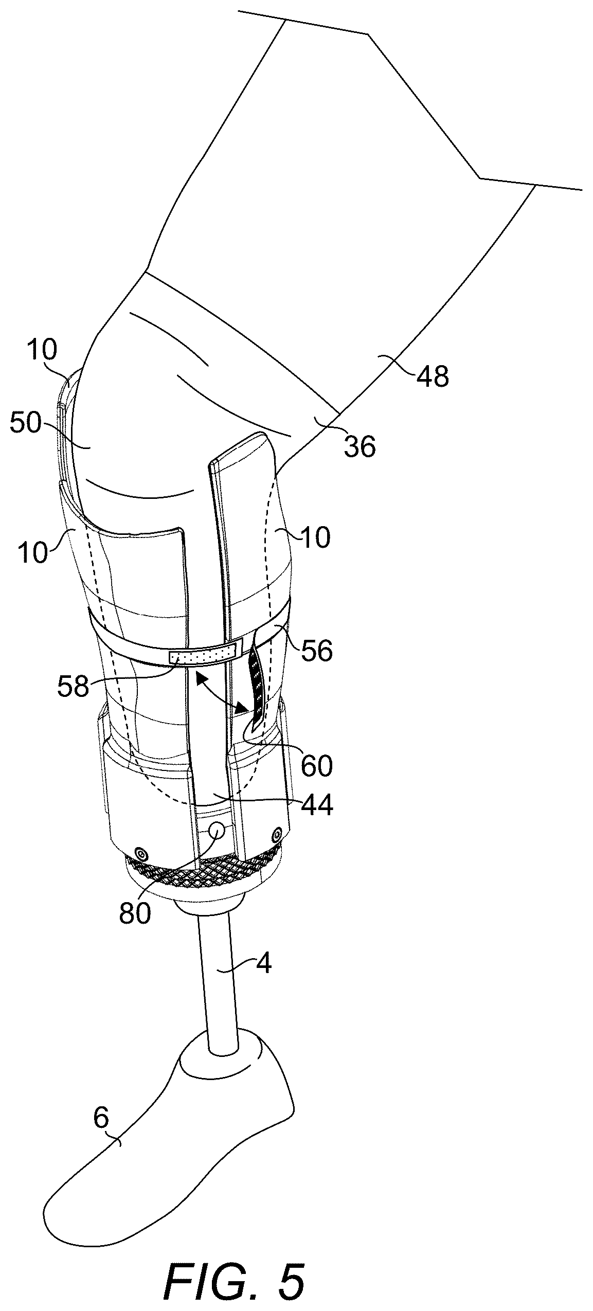 Patent US12376976 Figure 5 – Prosthetic socket