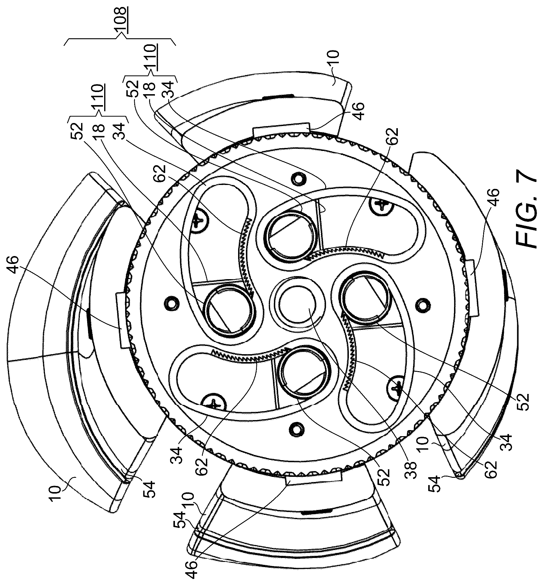 Patent US12376976 Figure 7 – Prosthetic socket