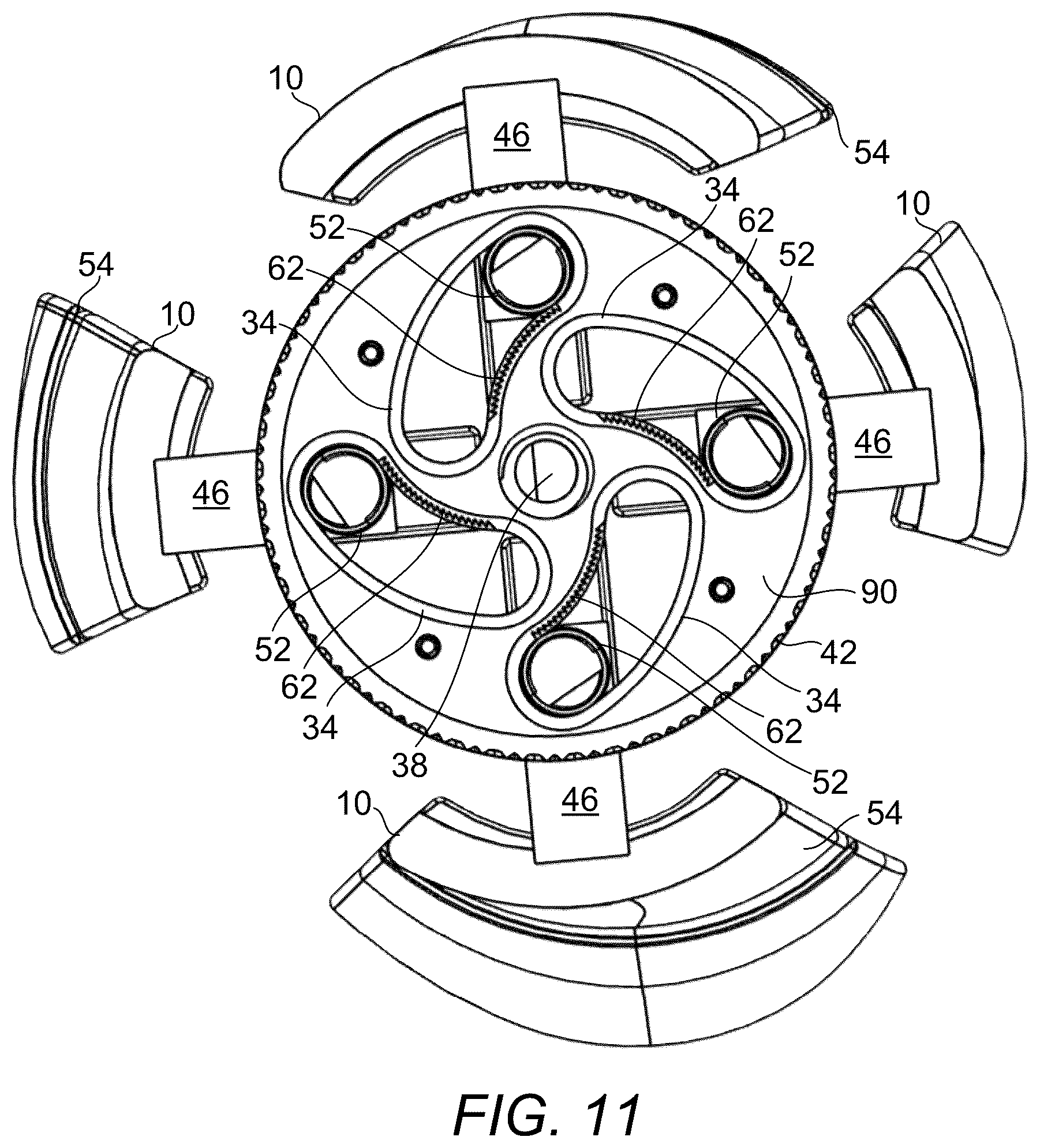 Patent US12376976 Figure 11 – Prosthetic socket