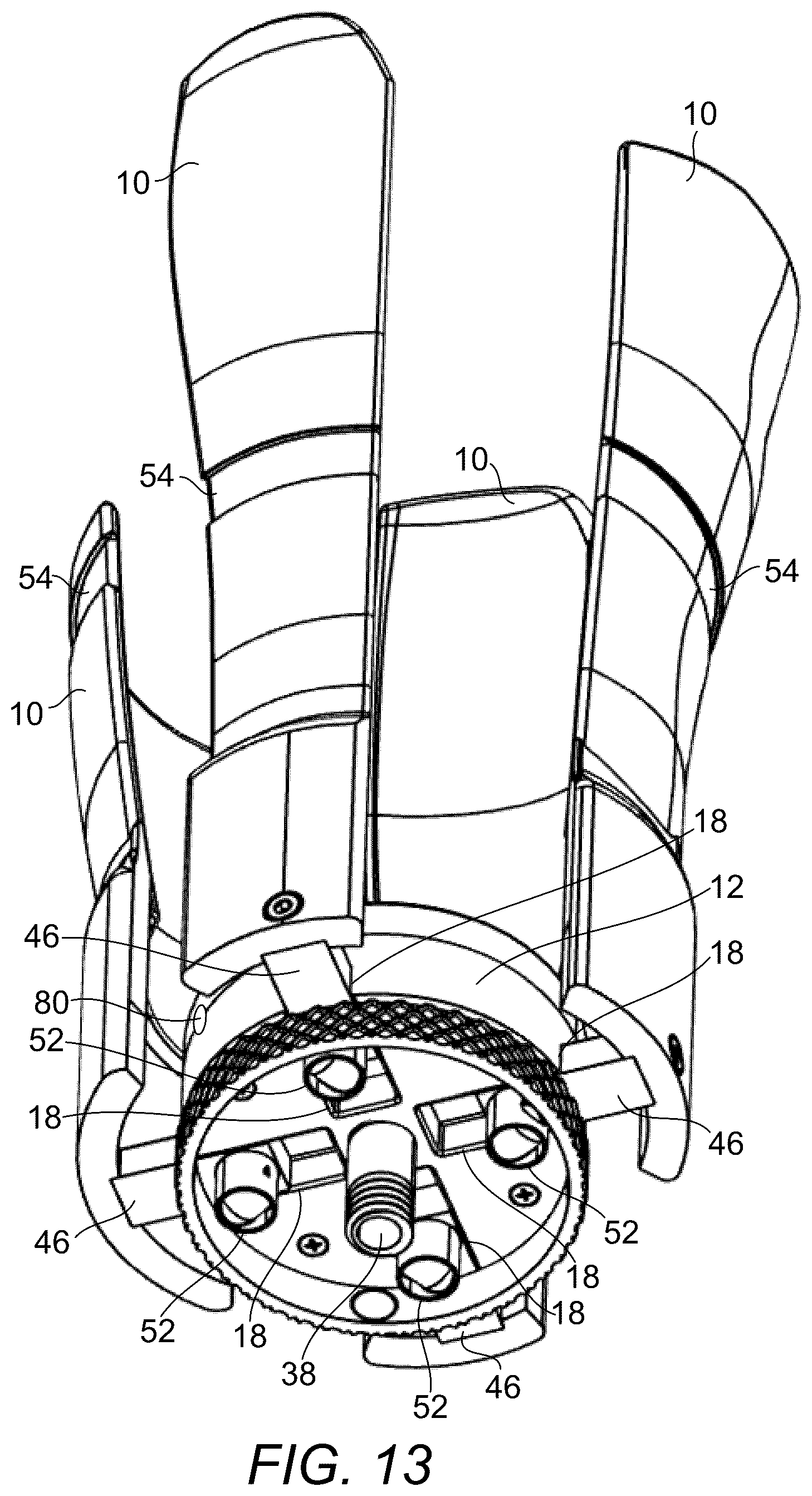 Patent US12376976 Figure 13 – Prosthetic socket