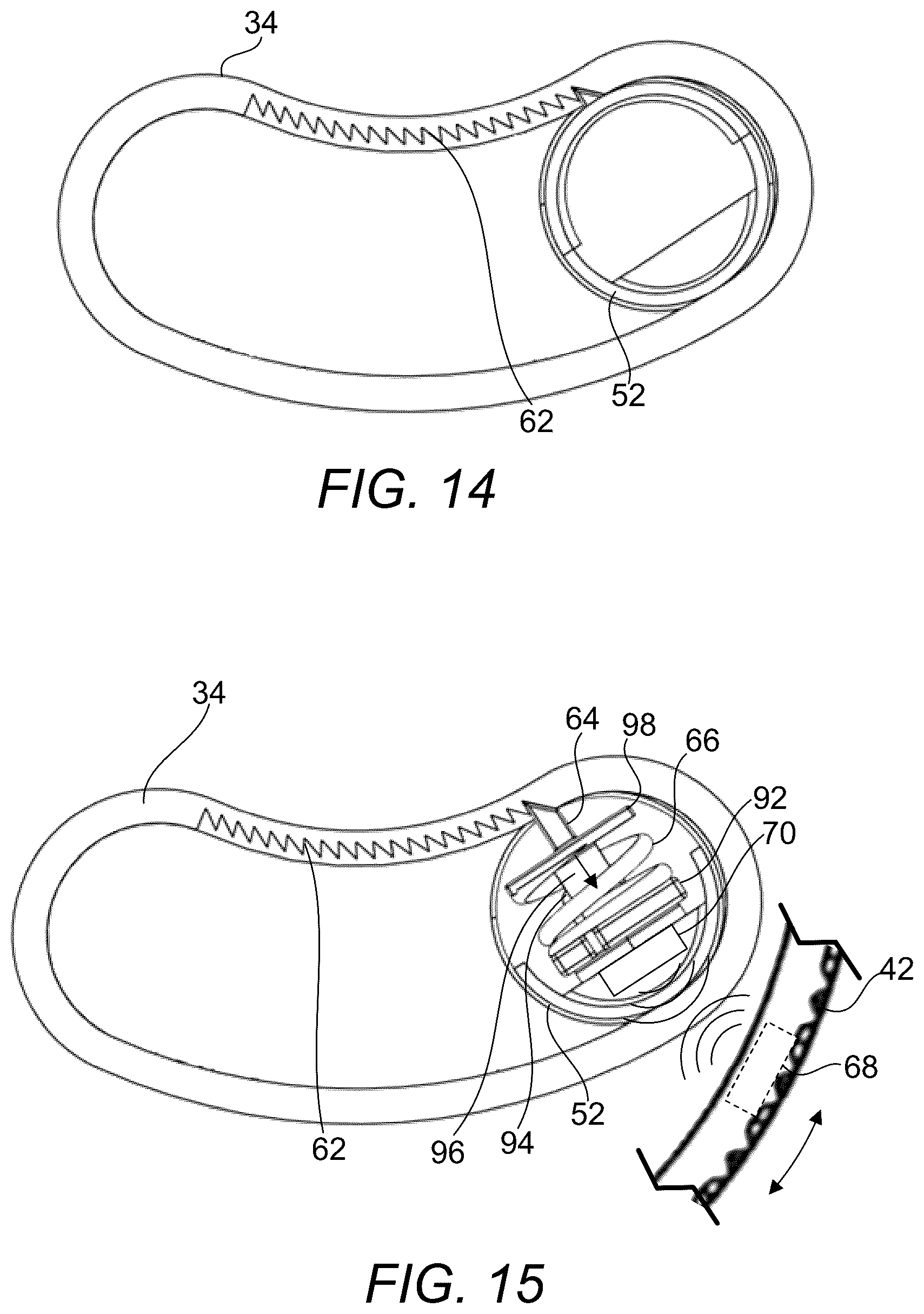 Patent US12376976 Figure 14 – Prosthetic socket