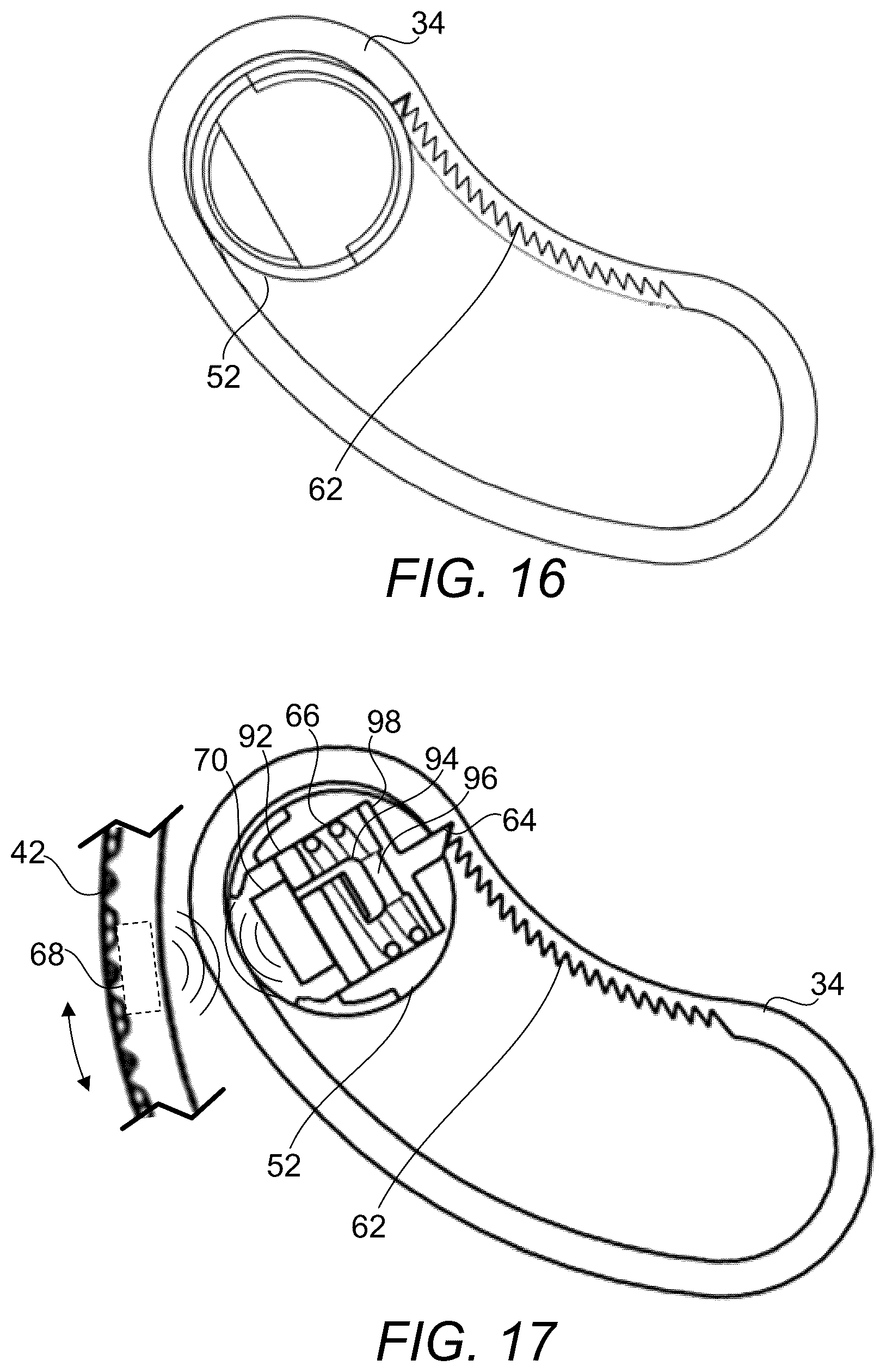 Patent US12376976 Figure 15 – Prosthetic socket