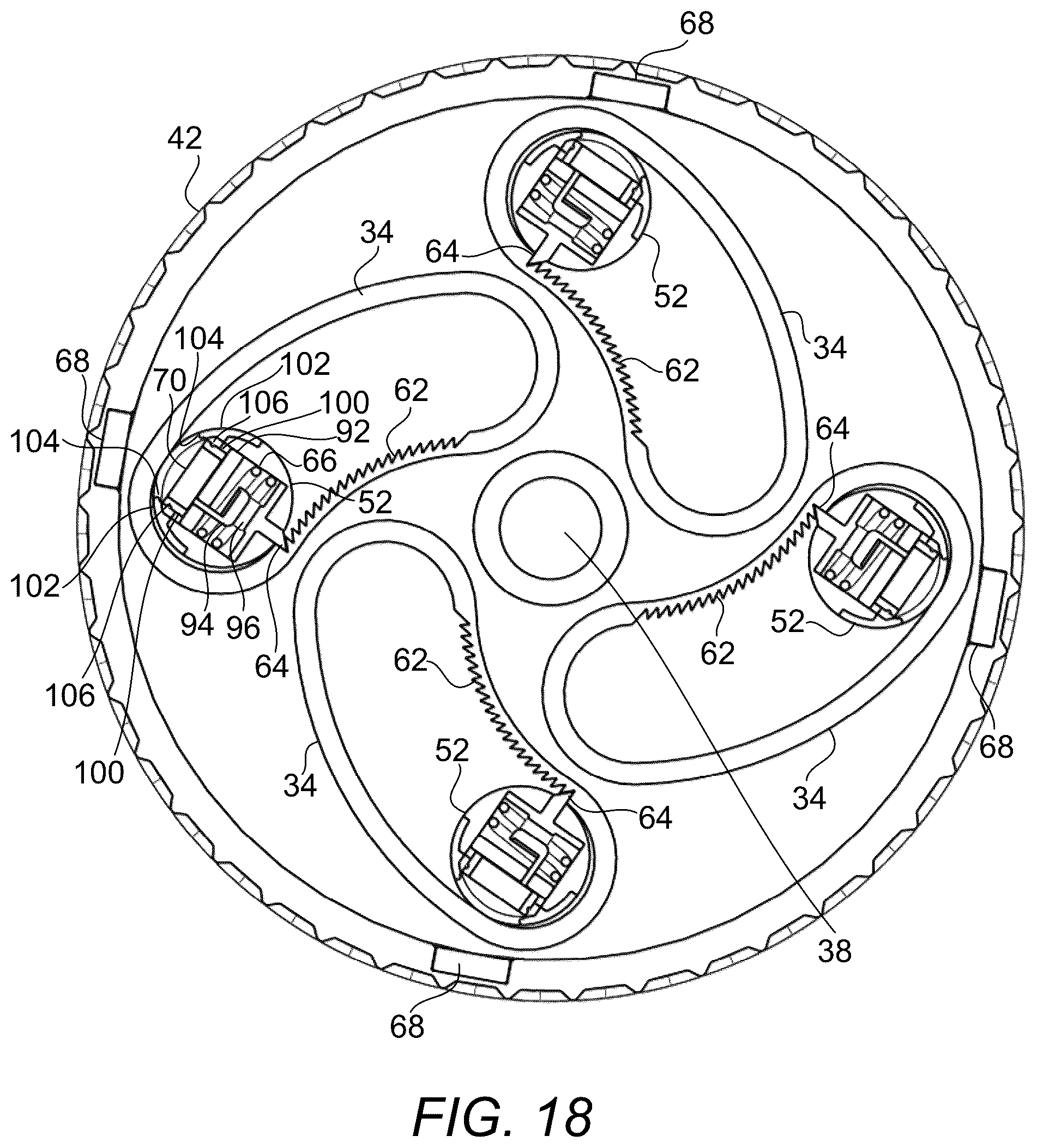 Patent US12376976 Figure 16 – Prosthetic socket