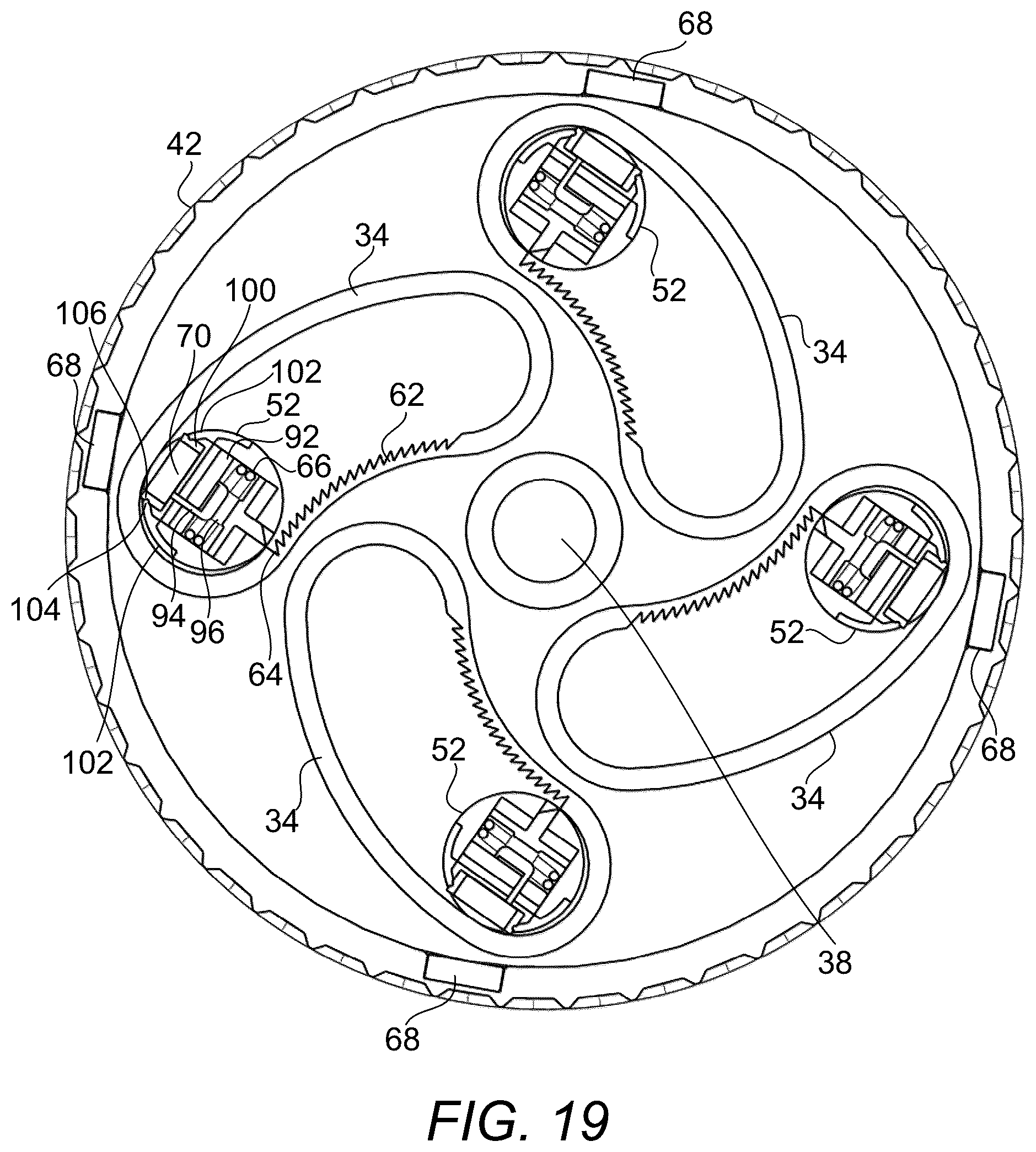 Patent US12376976 Figure 17 – Prosthetic socket