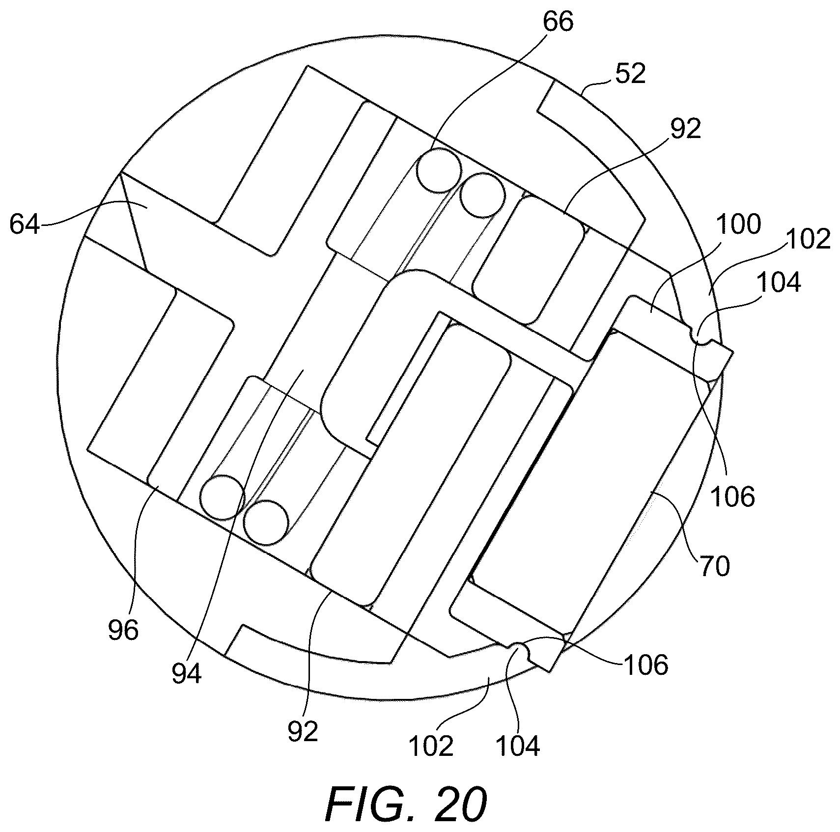 Patent US12376976 Figure 18 – Prosthetic socket
