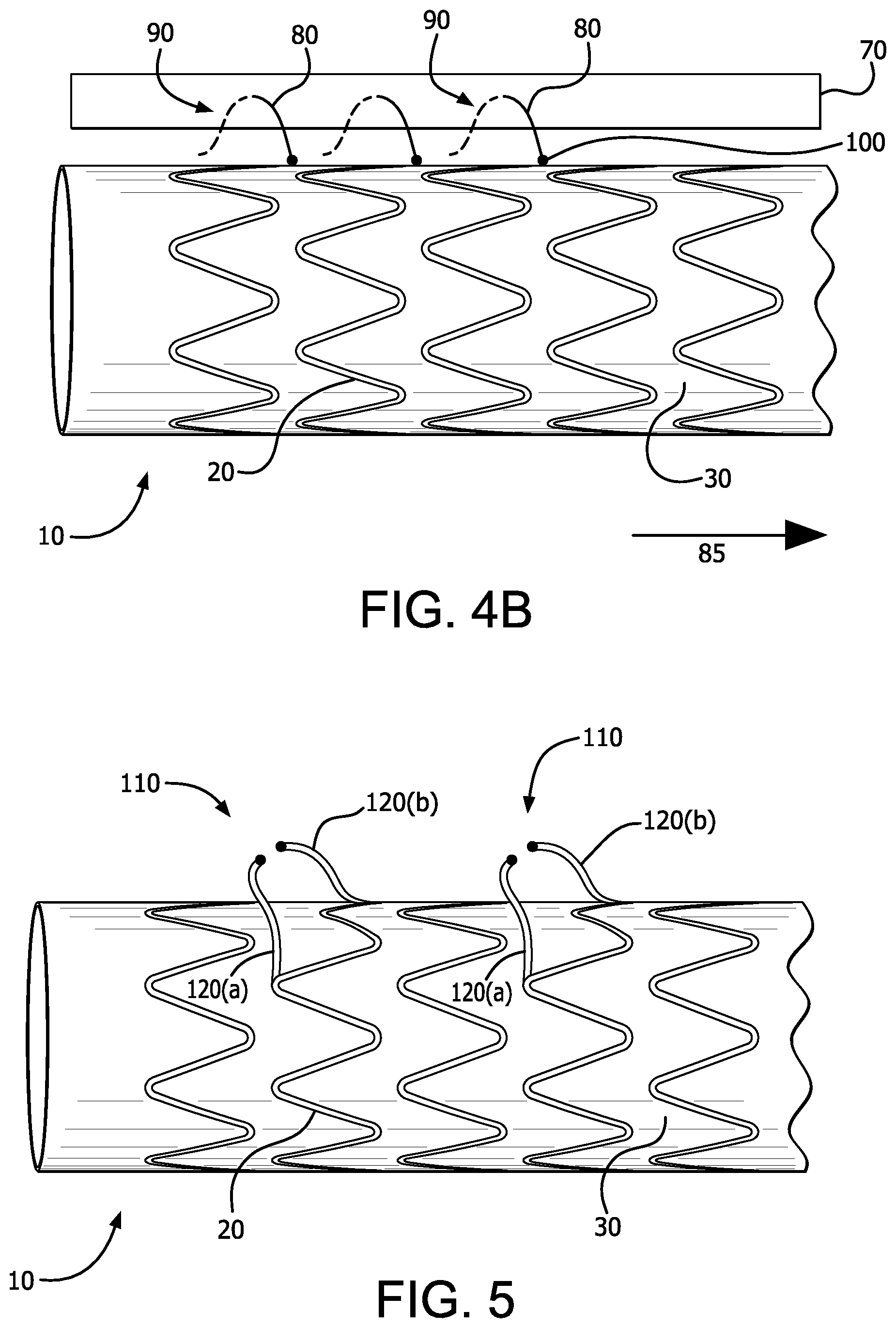 Patent US12376977 Figure 4 – Stent graft device with anchoring members having adjustable geometries
