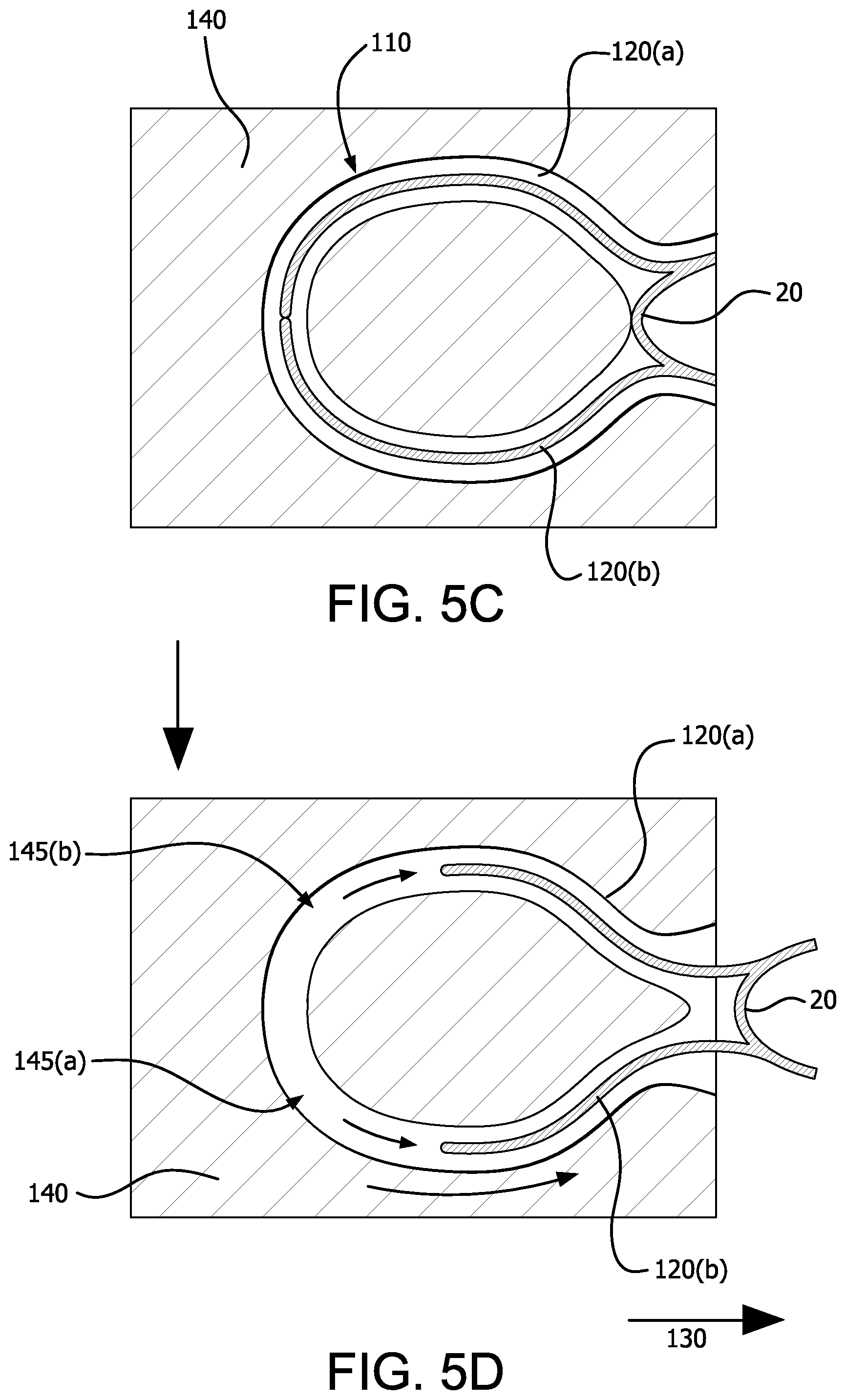 Patent US12376977 Figure 6 – Stent graft device with anchoring members having adjustable geometries