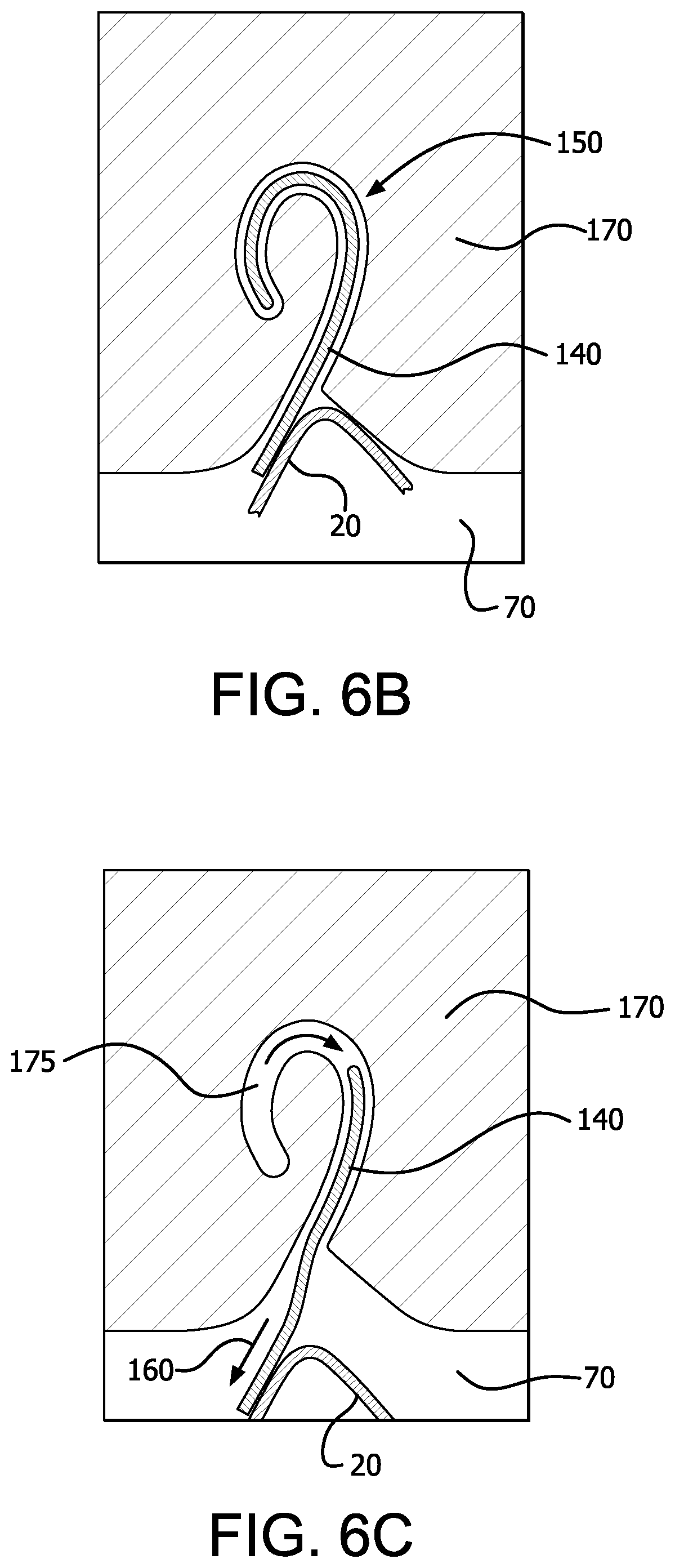 Patent US12376977 Figure 8 – Stent graft device with anchoring members having adjustable geometries