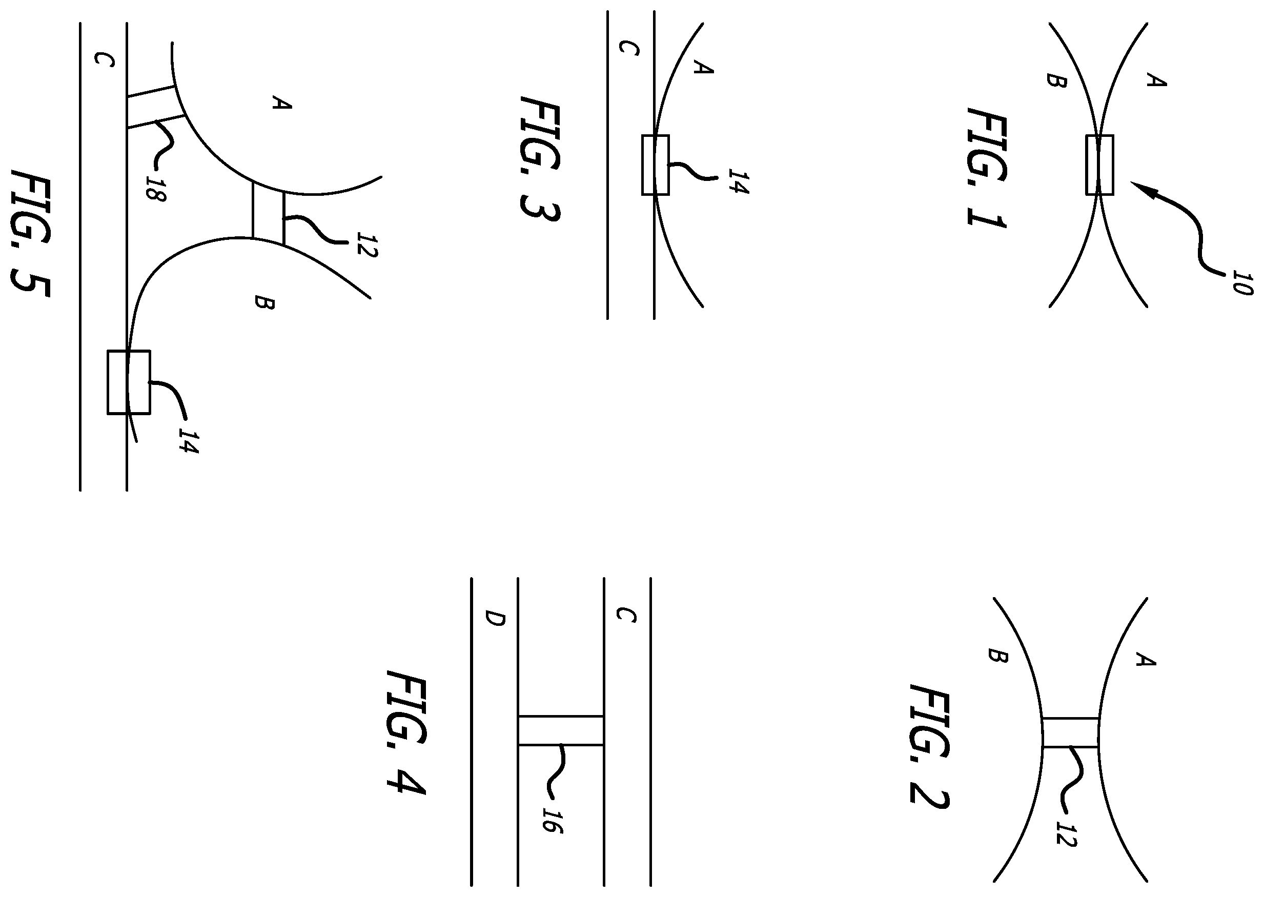 Patent US12376978 Figure 1 – Methods and technology for creating connections and shunts between vessels and chambers of biologic structures