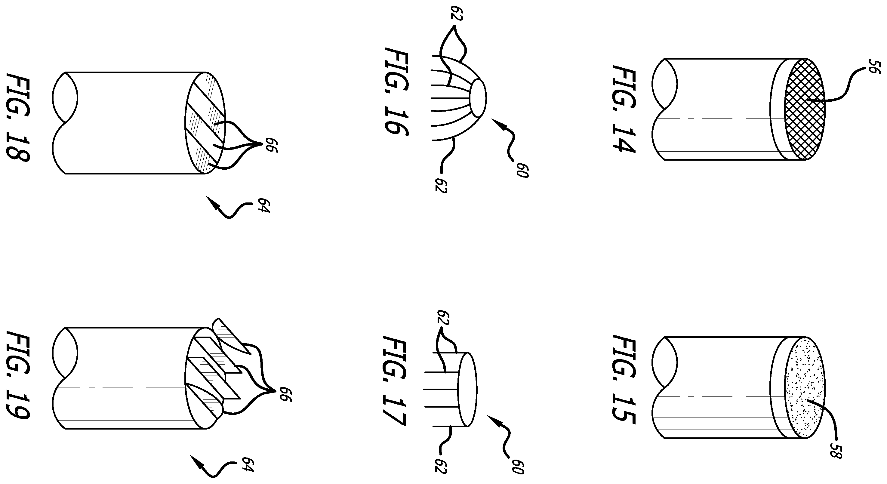 Patent US12376978 Figure 5 – Methods and technology for creating connections and shunts between vessels and chambers of biologic structures